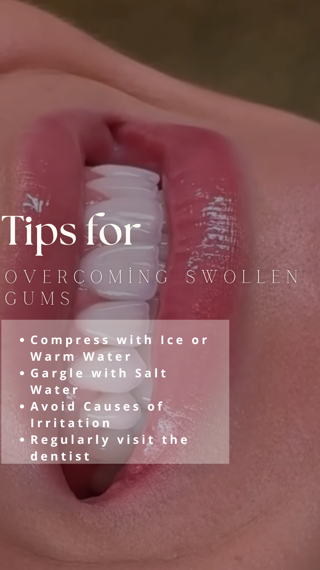 swollen gums .png