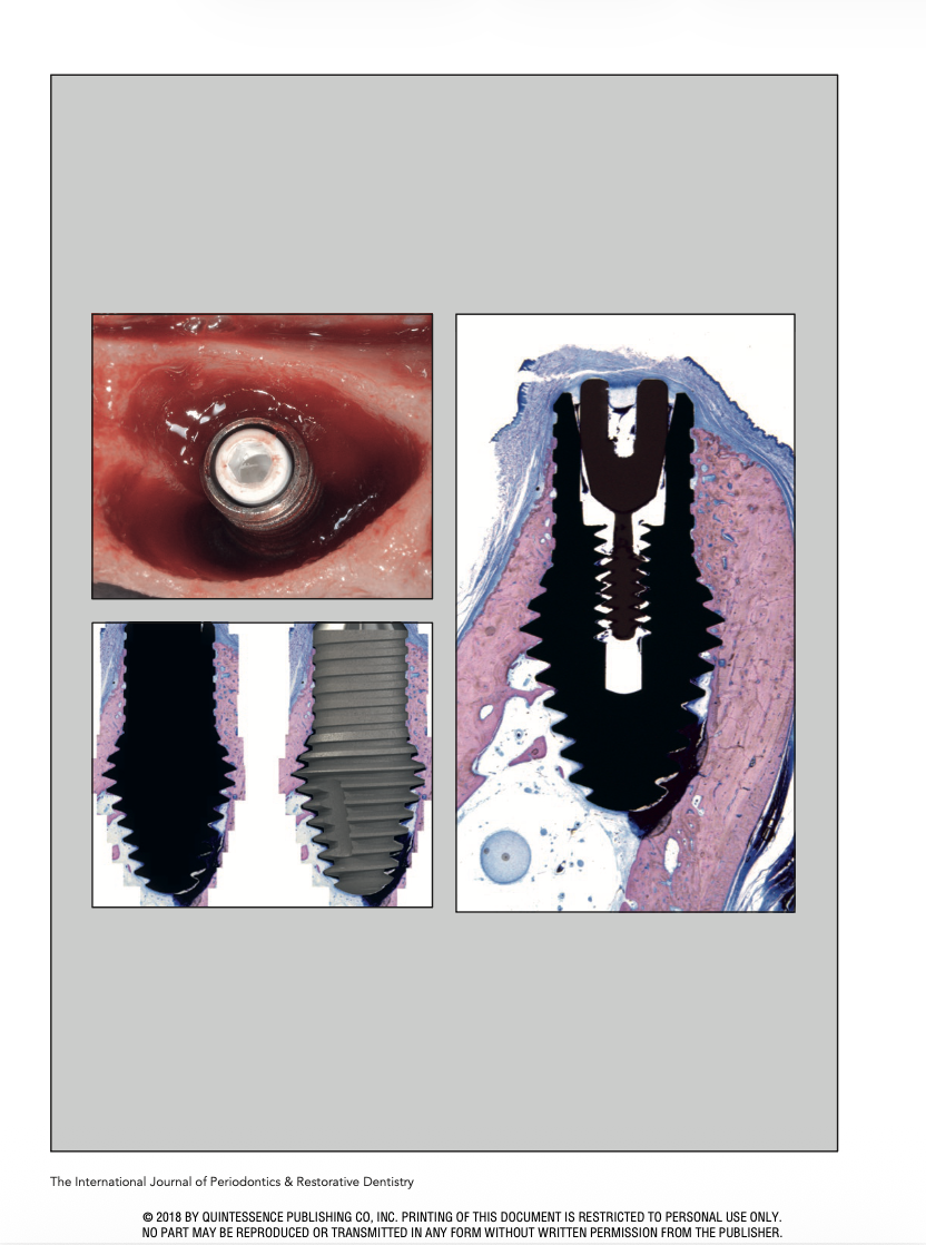 Evaluation of an Innovative Hybrid Macrogeometry Dental Implant in Immediate Extraction Sockets: A Histomorphometric Pilot Study in Foxhound Dogs
