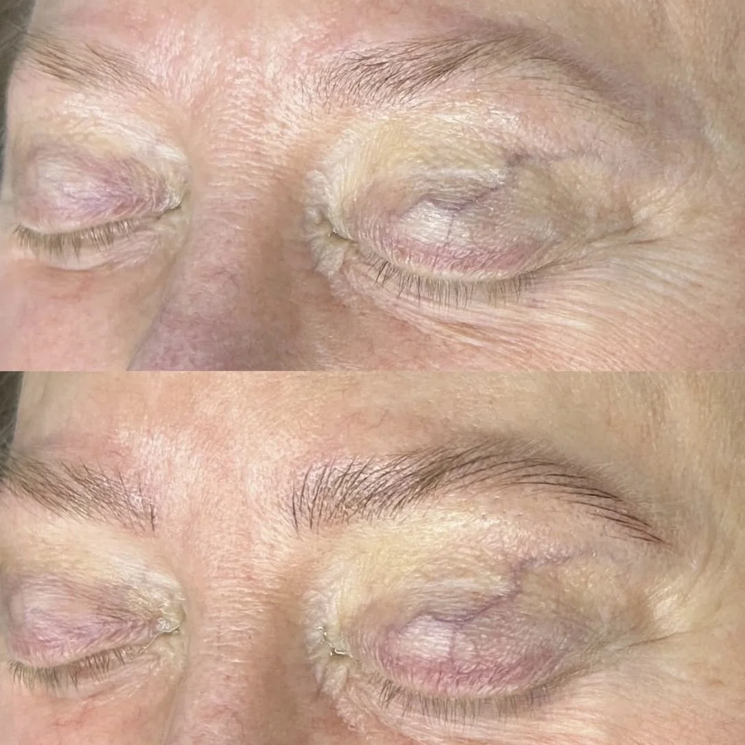 Microblading