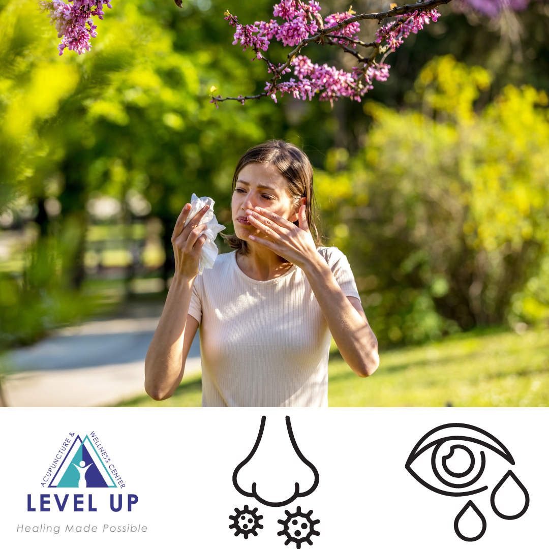 Natural Healing: How Acupuncture Can Alleviate Allergies 