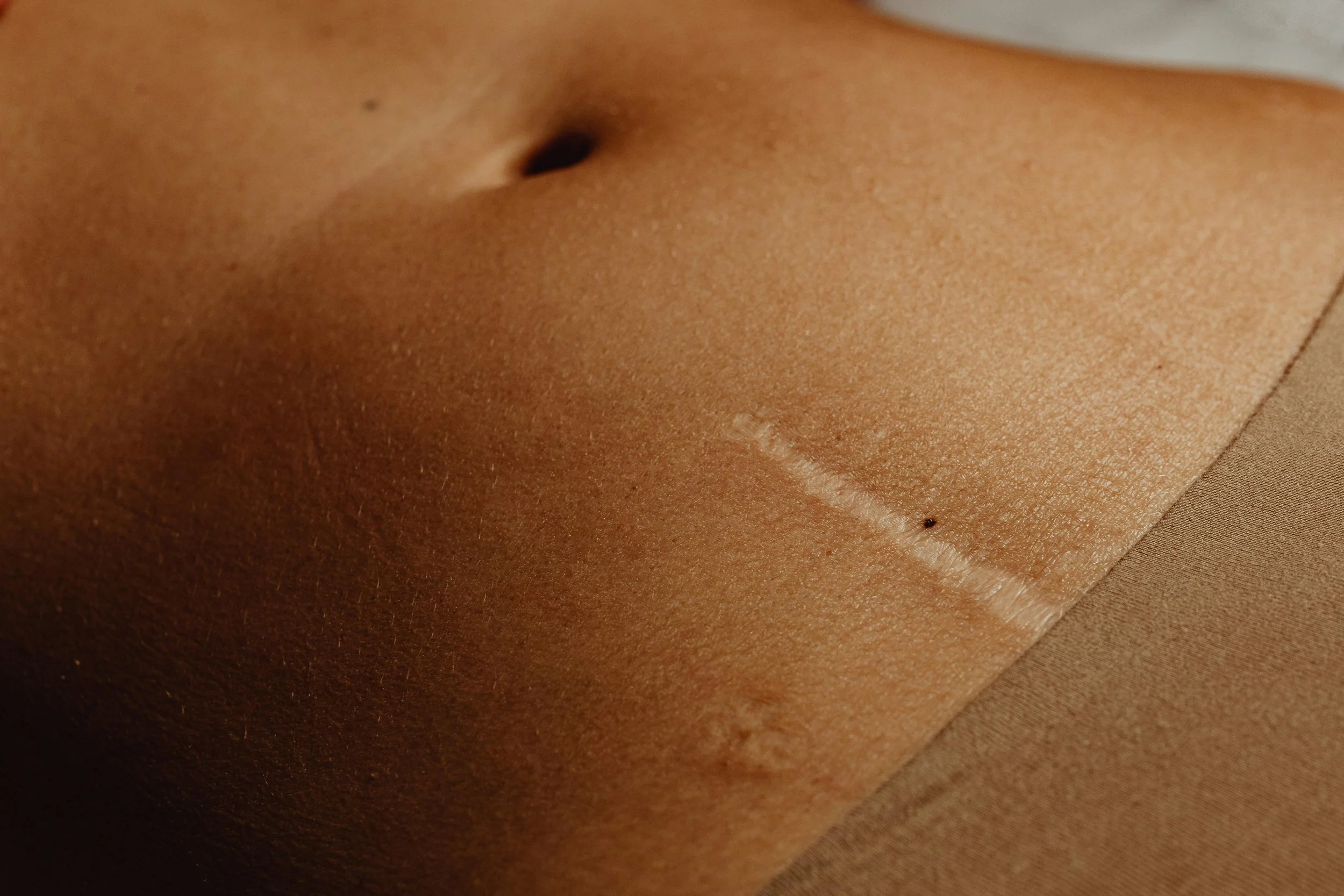 Close-up of a human skin with a small scar or healing wound, showing textured skin and pores.