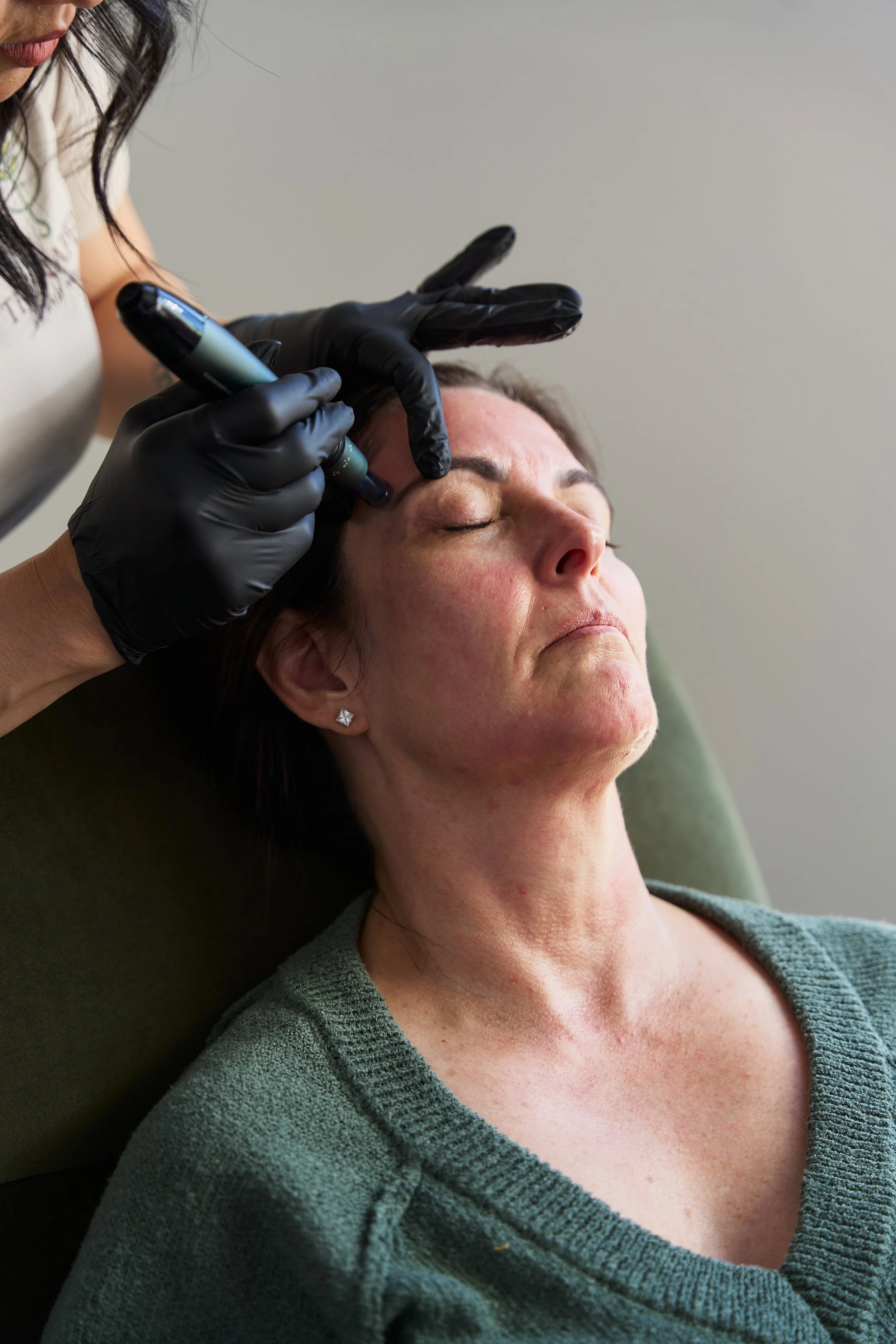 A woman is receiving a cosmetic injection or treatment on her forehead from a professional wearing black gloves.