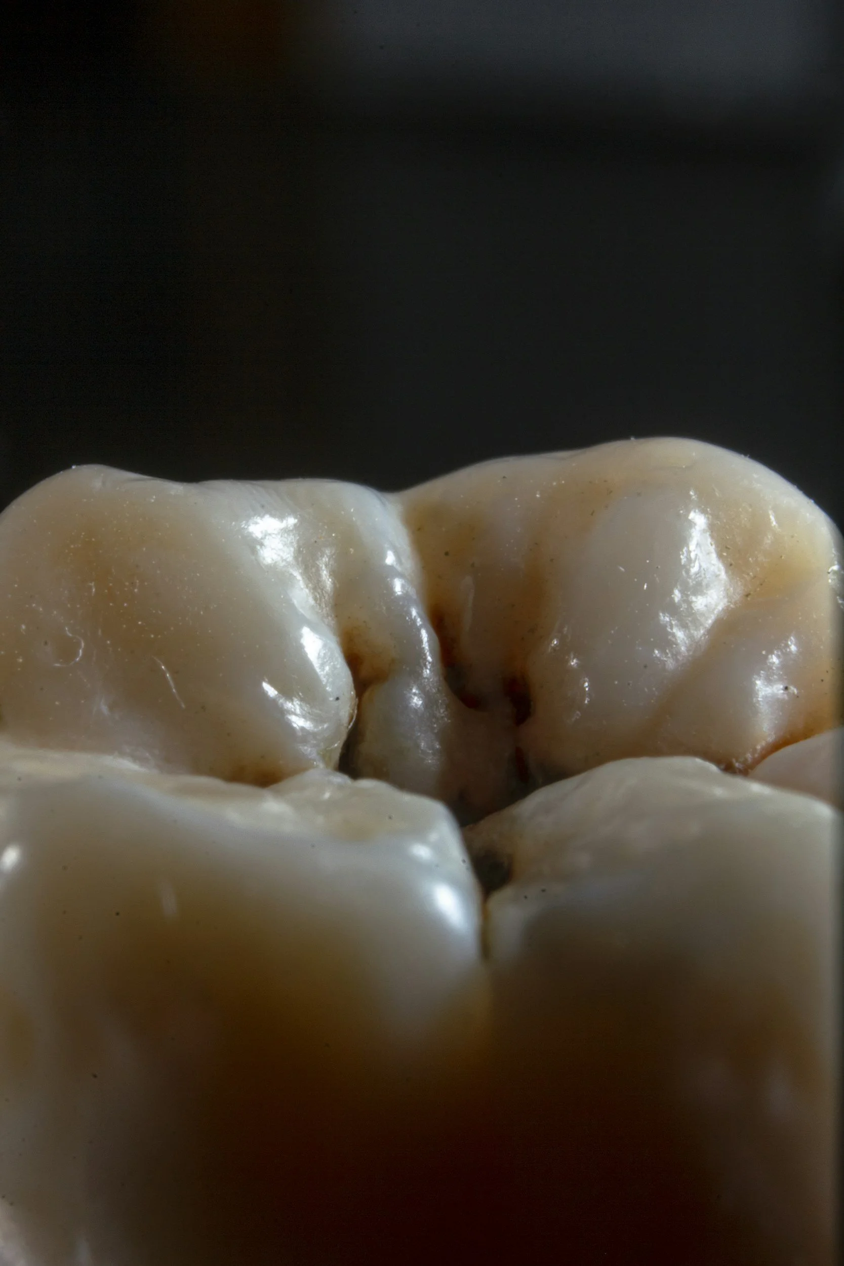 Zubný plak – tichý nepriateľ zdravého úsmevu