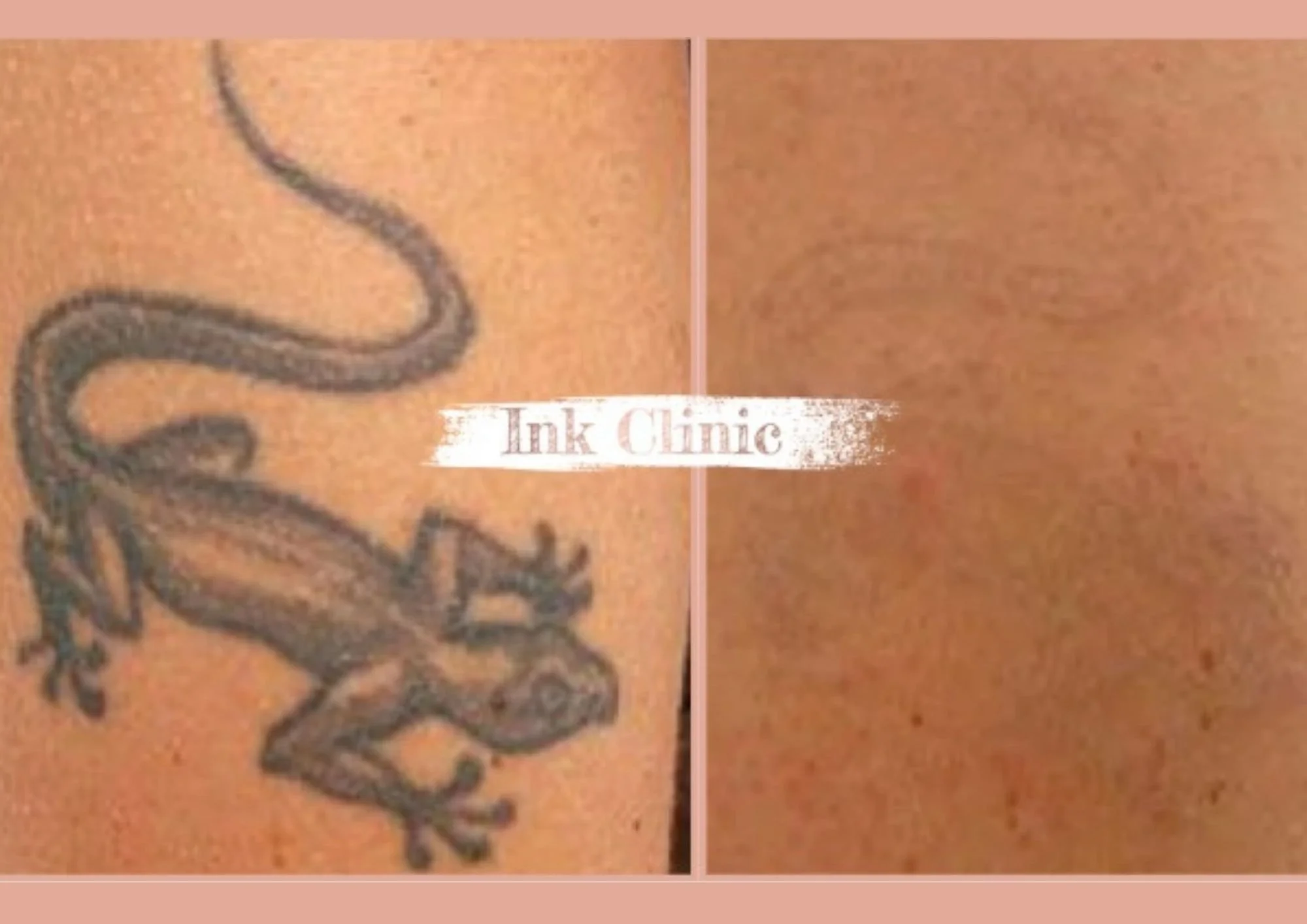 Ink Clinic (Instagram-bericht) (10).jpg