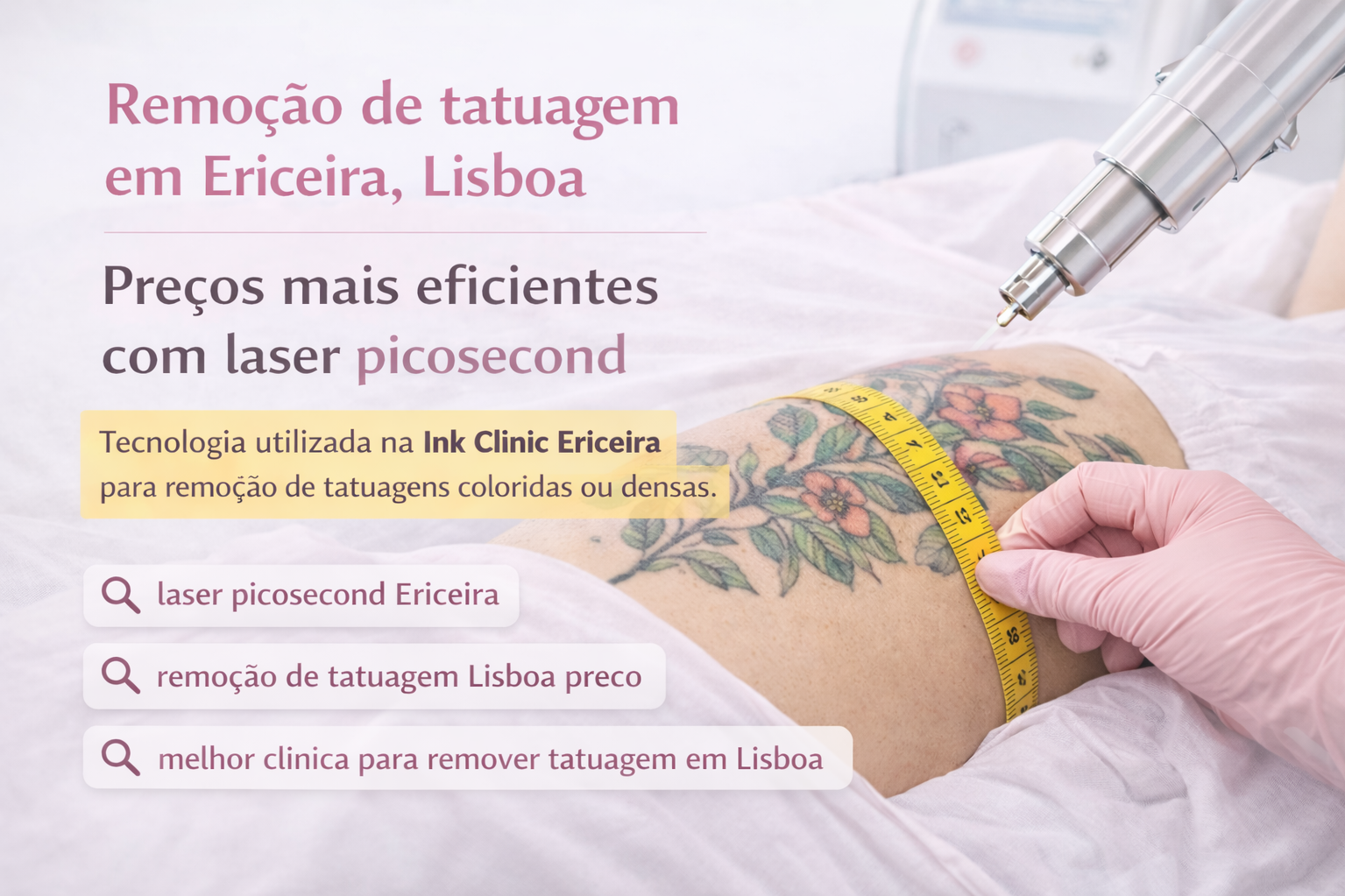 Remoção de Tatuagem. Valor Real por Sessão em Portugal