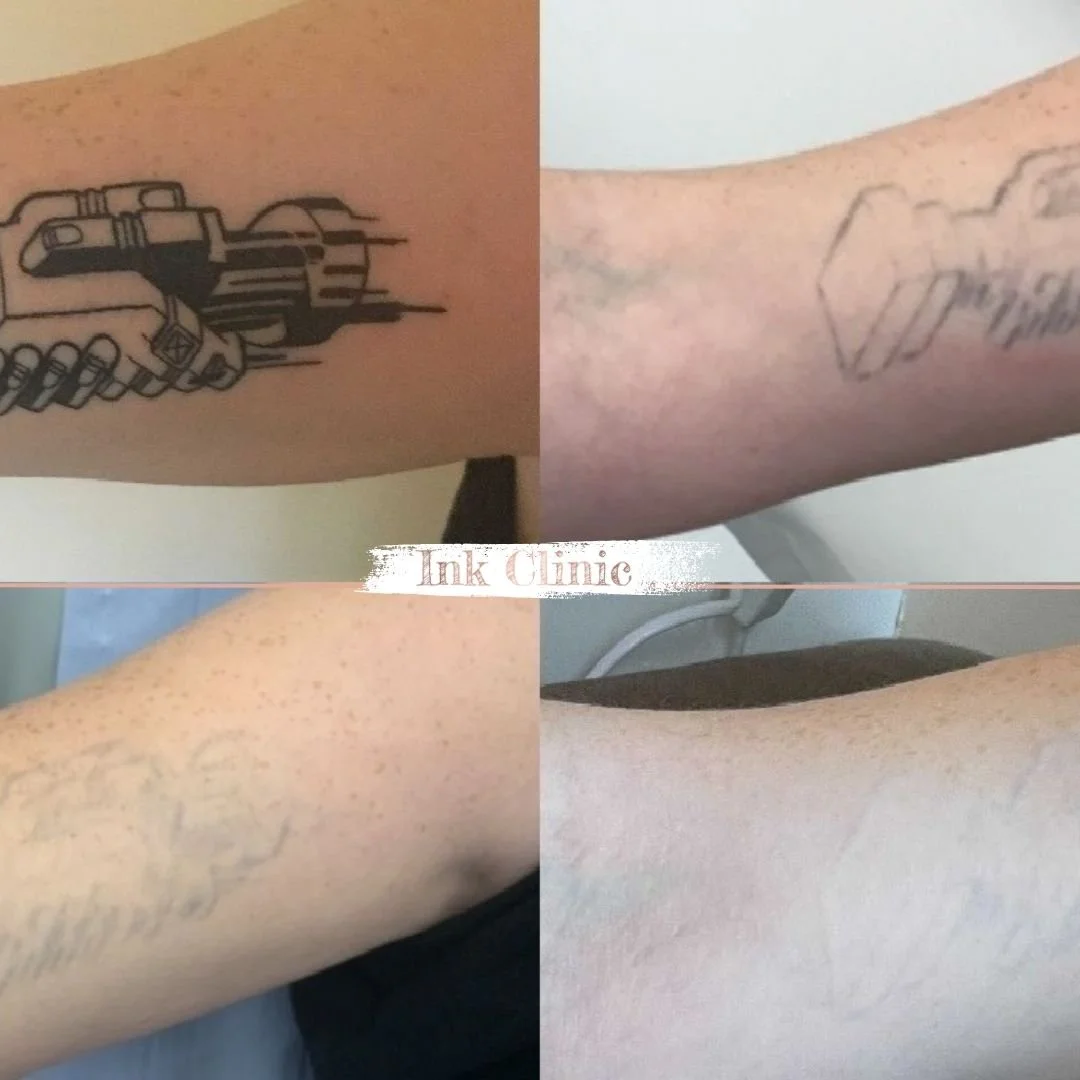 Ink Clinic (Instagram-bericht) (6).jpg