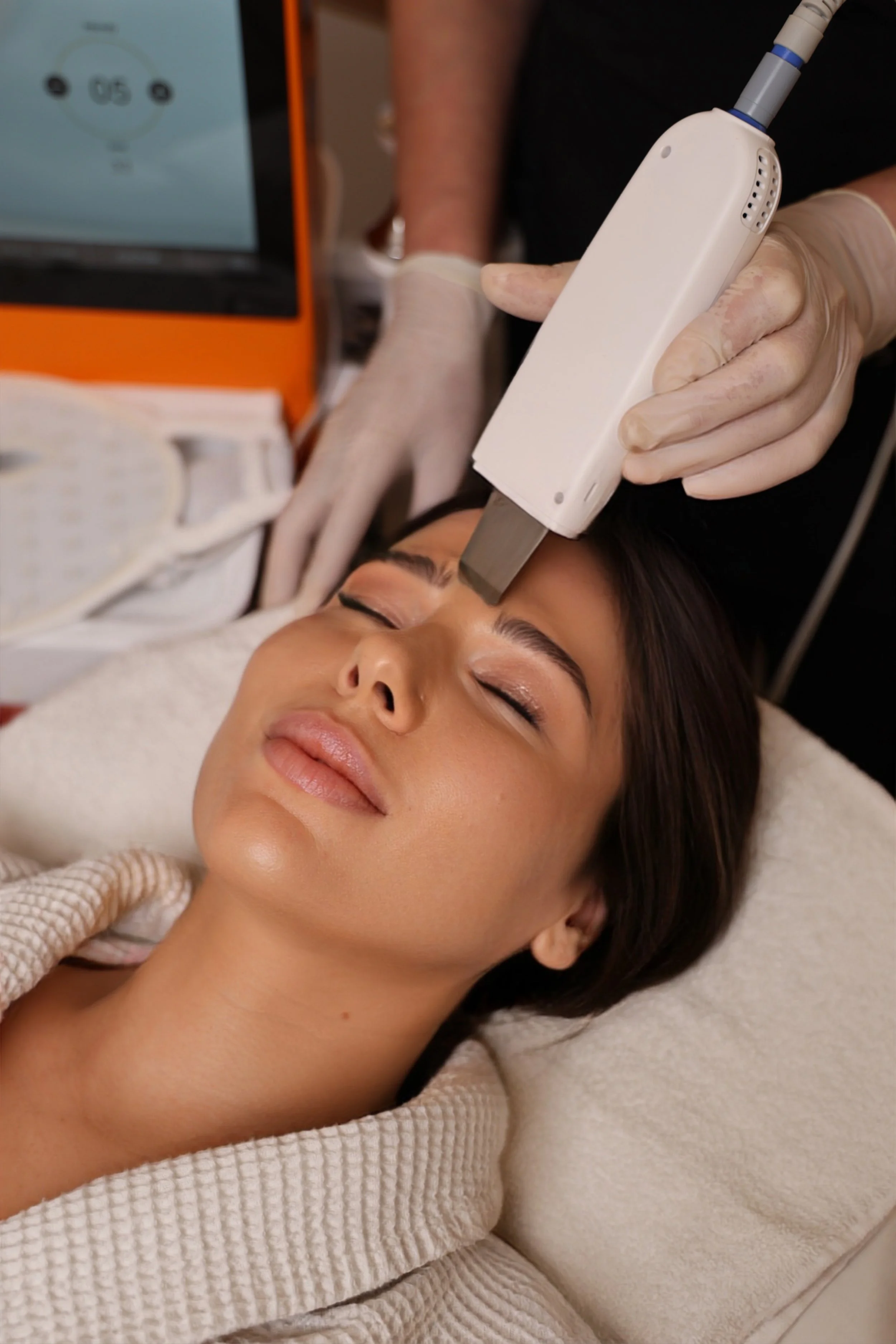 A woman receiving a cosmetic procedure with a handheld device on her forehead, while lying down with her eyes closed, in a clinical setting.