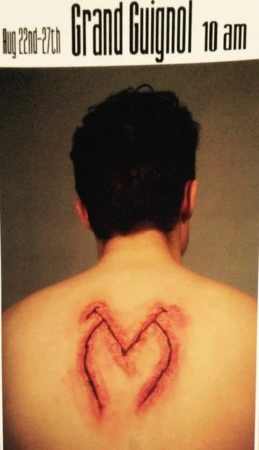 A person's back with a large, fresh scar in the shape of a heart.