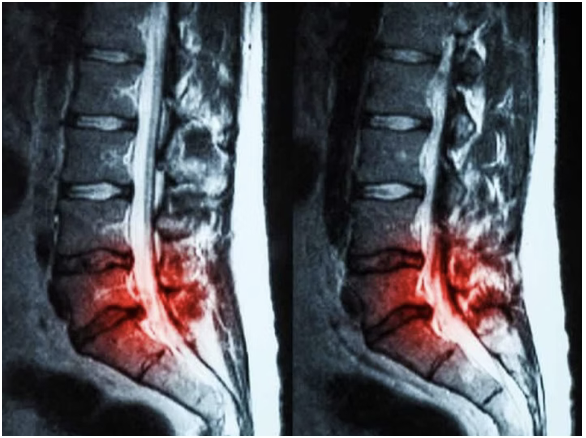 Let's look at that Back Pain...... again!