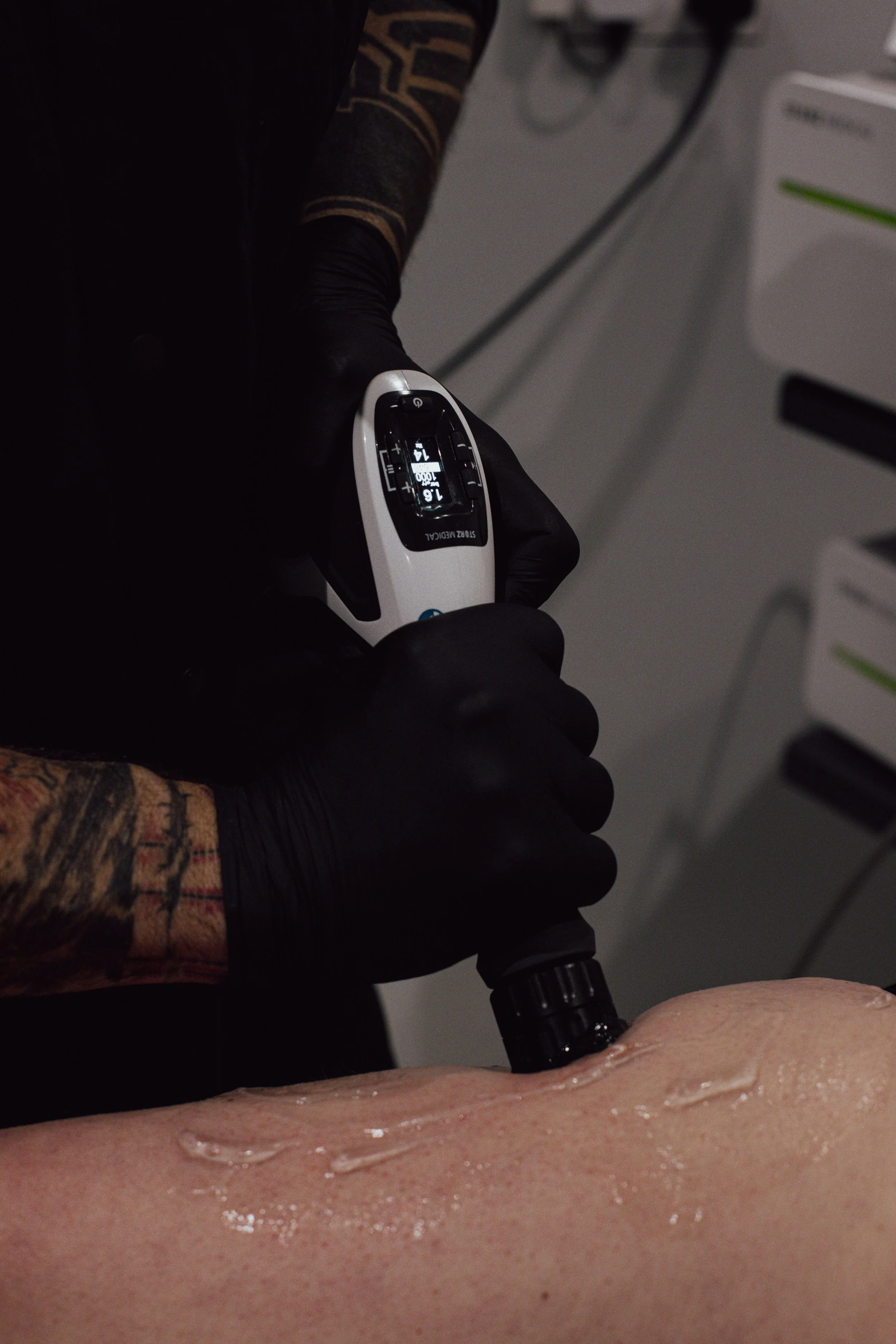 A medical professional wearing black gloves using radical shockwave therapy on a person's leg in a clinical setting.