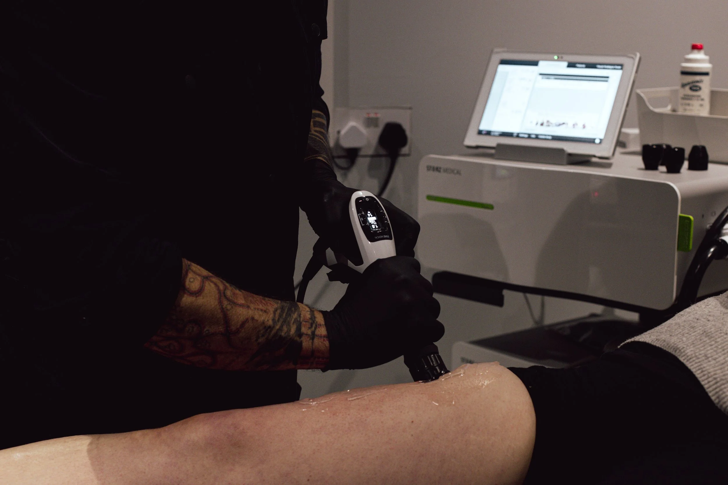 A tattooed person wearing black gloves uses a radical shockwave device on a person's leg during a treatment in a clinical setting, with the main Shockwave therapy device and  monitor in the background.