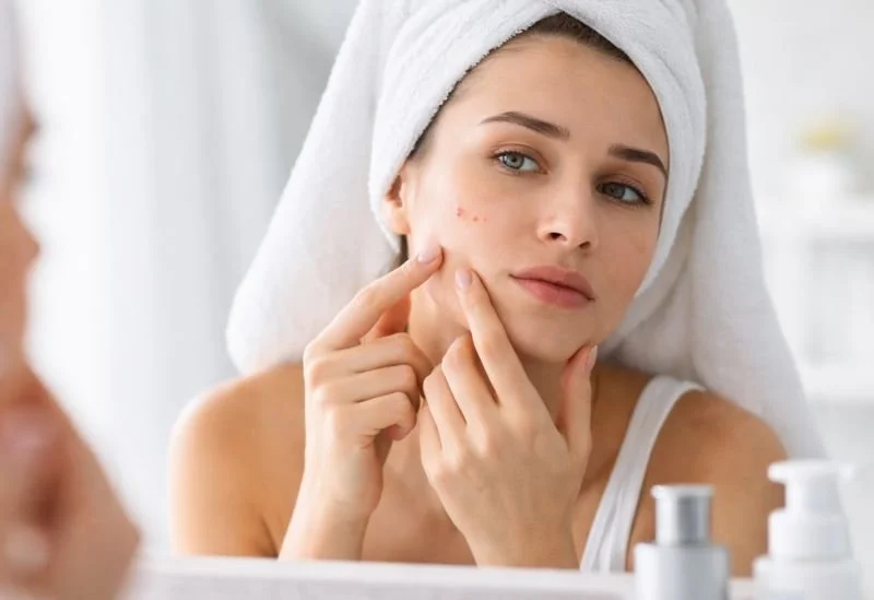 On éteint les spots –  Imperfections cutanées