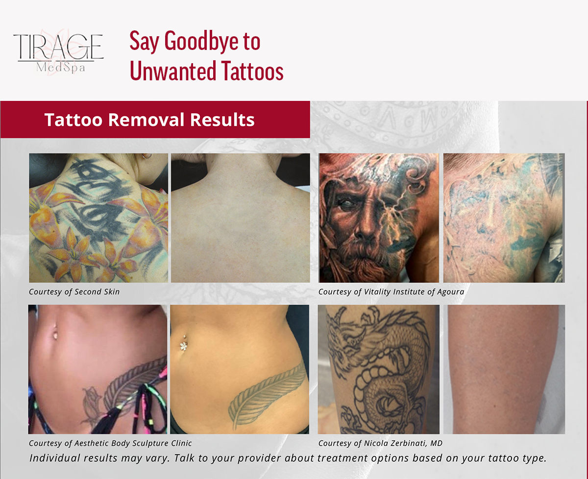 tirage_medspa_laser_tattoo_removal_marketing_google_ads2.png