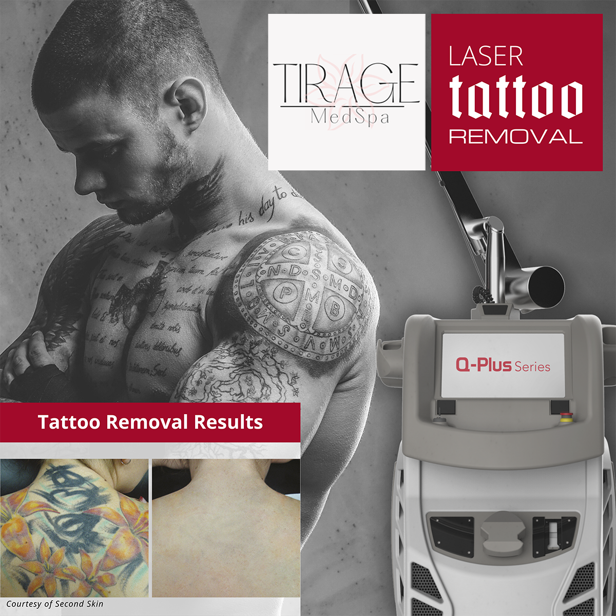 tirage_medspa_laser_tattoo_removal_marketing_google_ads.png