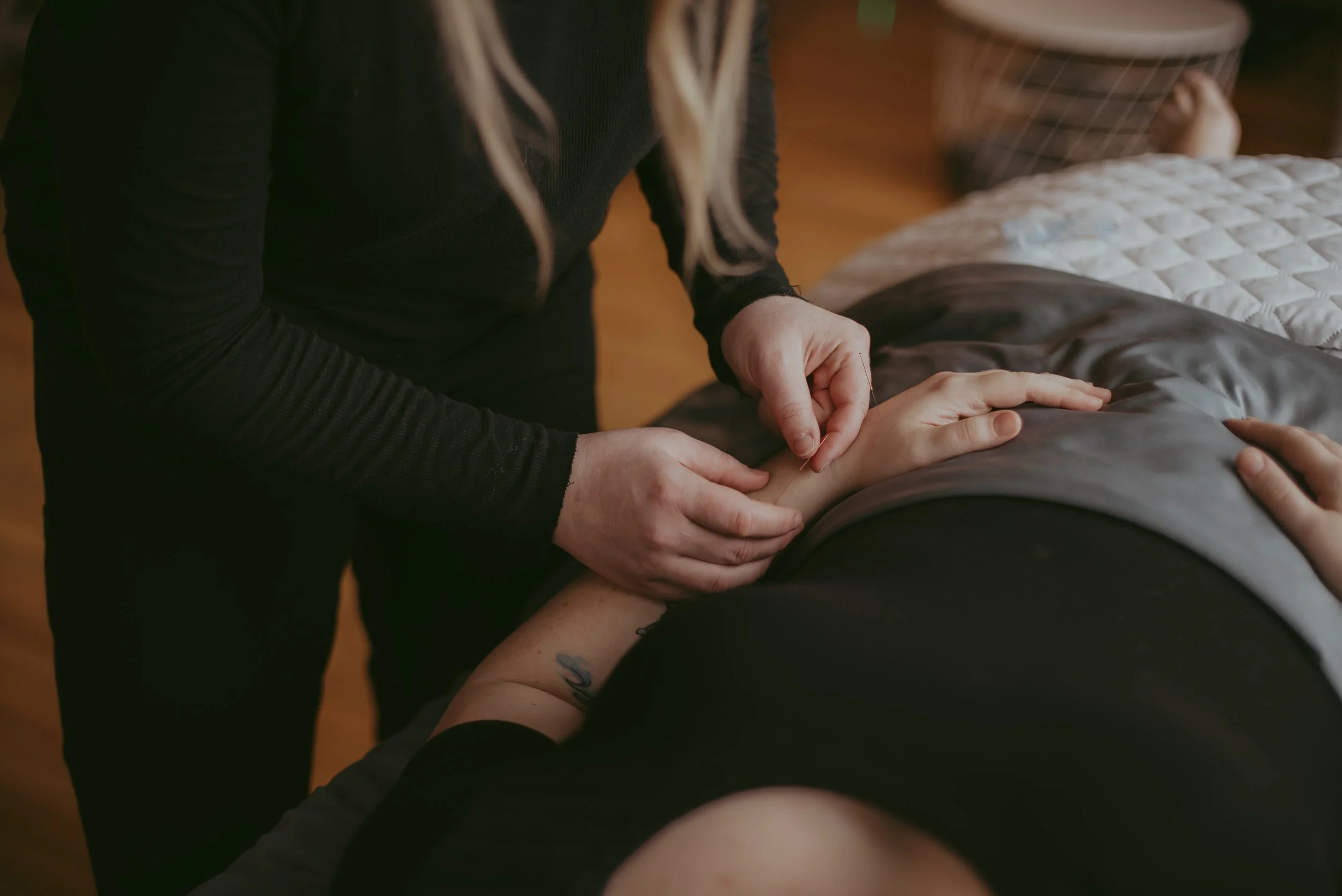 Person receiving acupuncture treatment on their forearm from a practitioner in a dimly lit room.