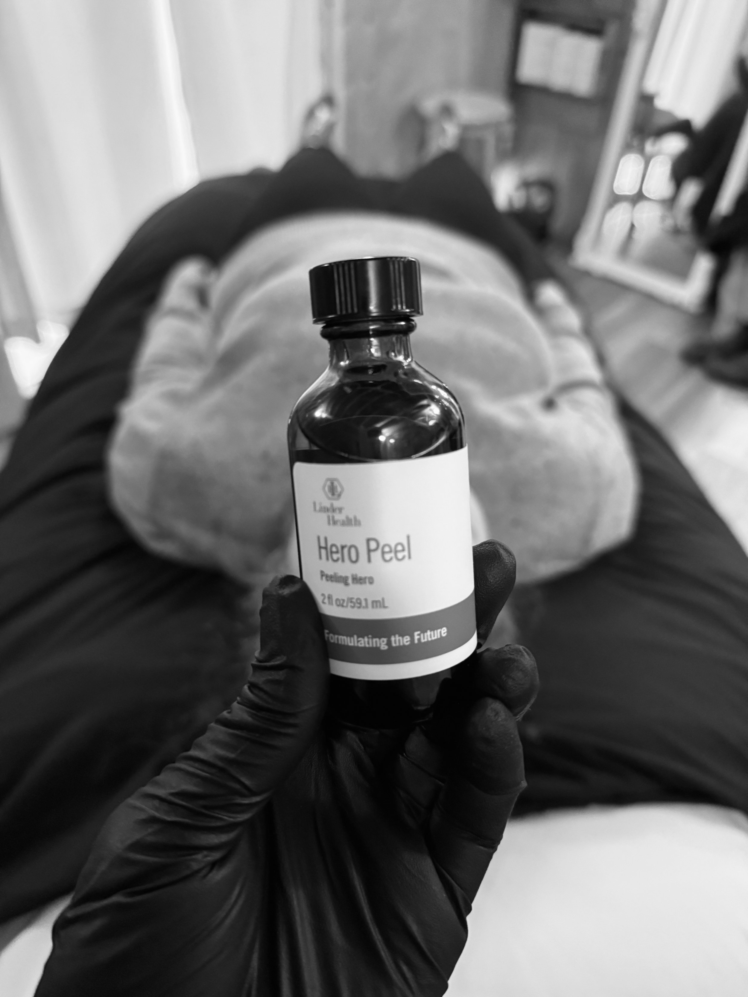 The Long-Term Role of Chemical Peels