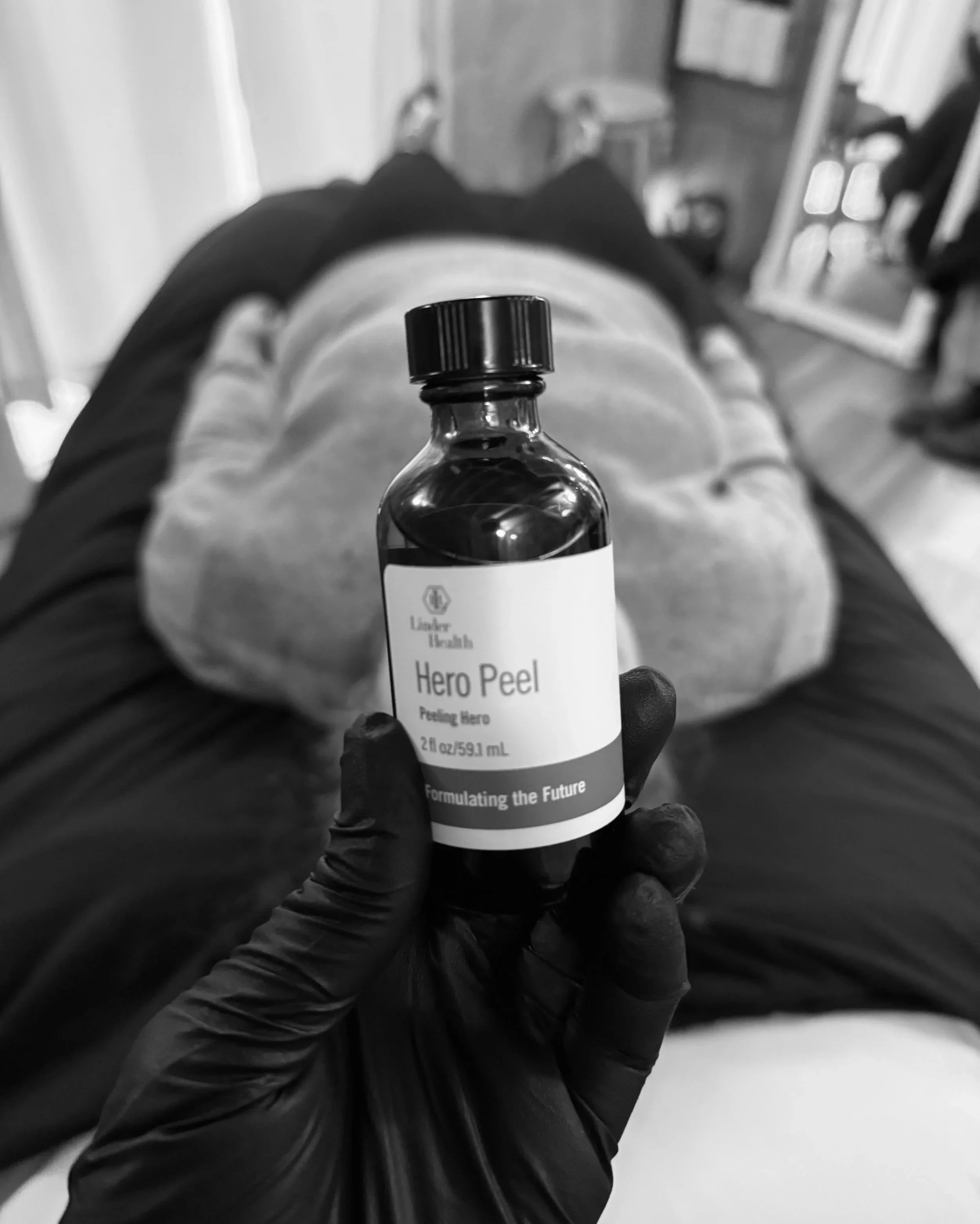 The Long-Term Role of Chemical Peels