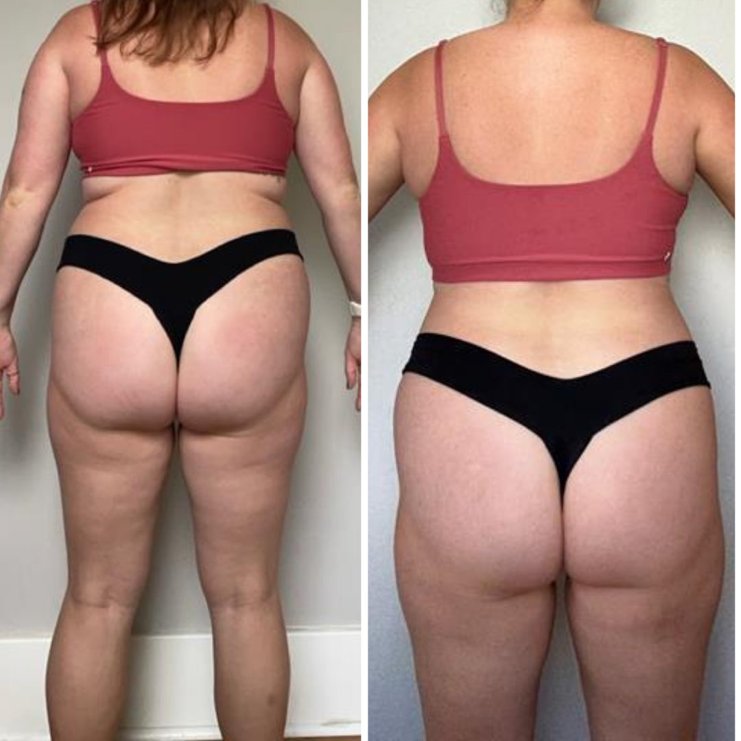 Side-by-side comparison of a woman’s back before and after weight loss, wearing a pink sports bra and black underwear.