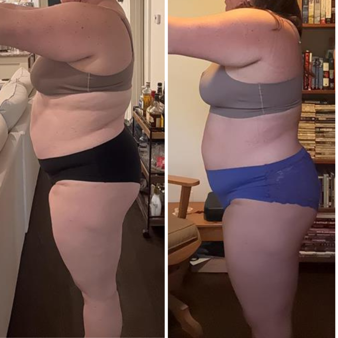 Side-by-side photos of a woman's torso and legs before and after weight loss, showing a reduction in body fat and a slimmer profile.