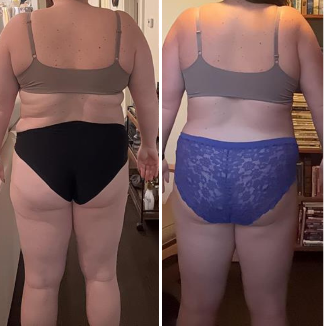 Side-by-side photos of the same woman, showing her back before and after weight loss. She is wearing a beige bra and different underwear in each photo, with a background of a room with bookshelves and personal items.