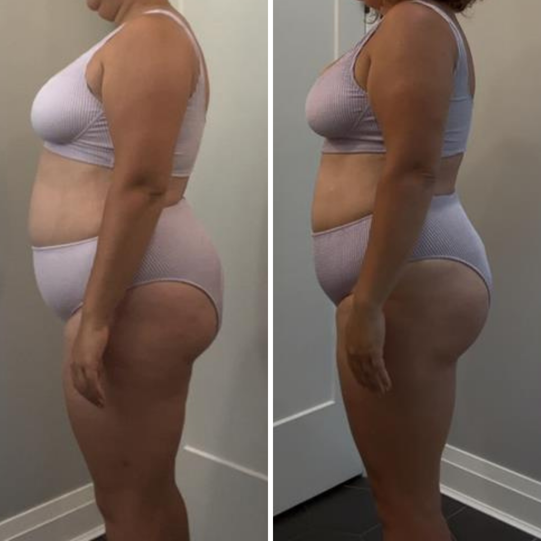 Comparison of a woman before and after losing weight, shown from the side in light-colored workout clothes.