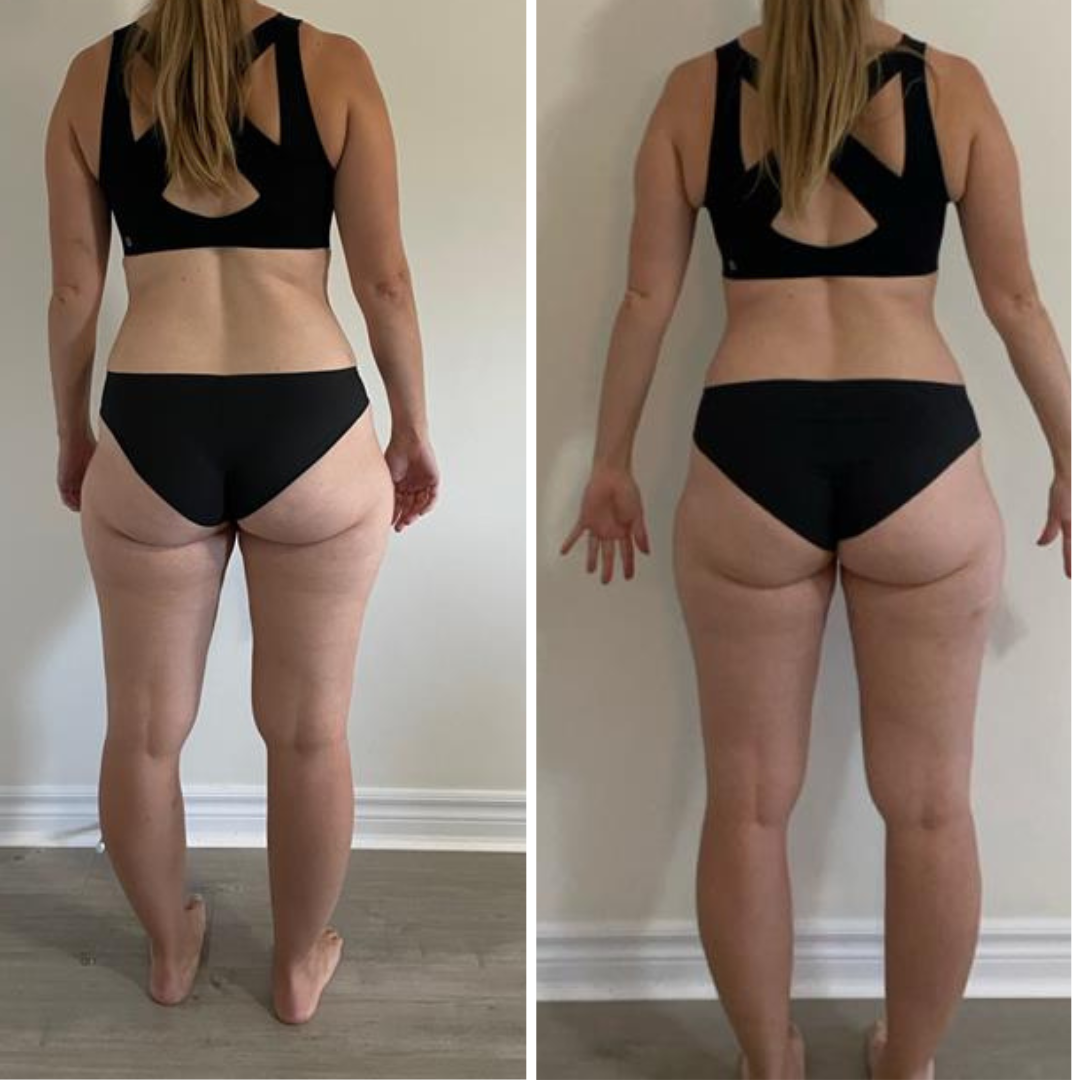 Side-by-side comparison of a woman in black underwear before and after weight loss, standing against a plain wall.