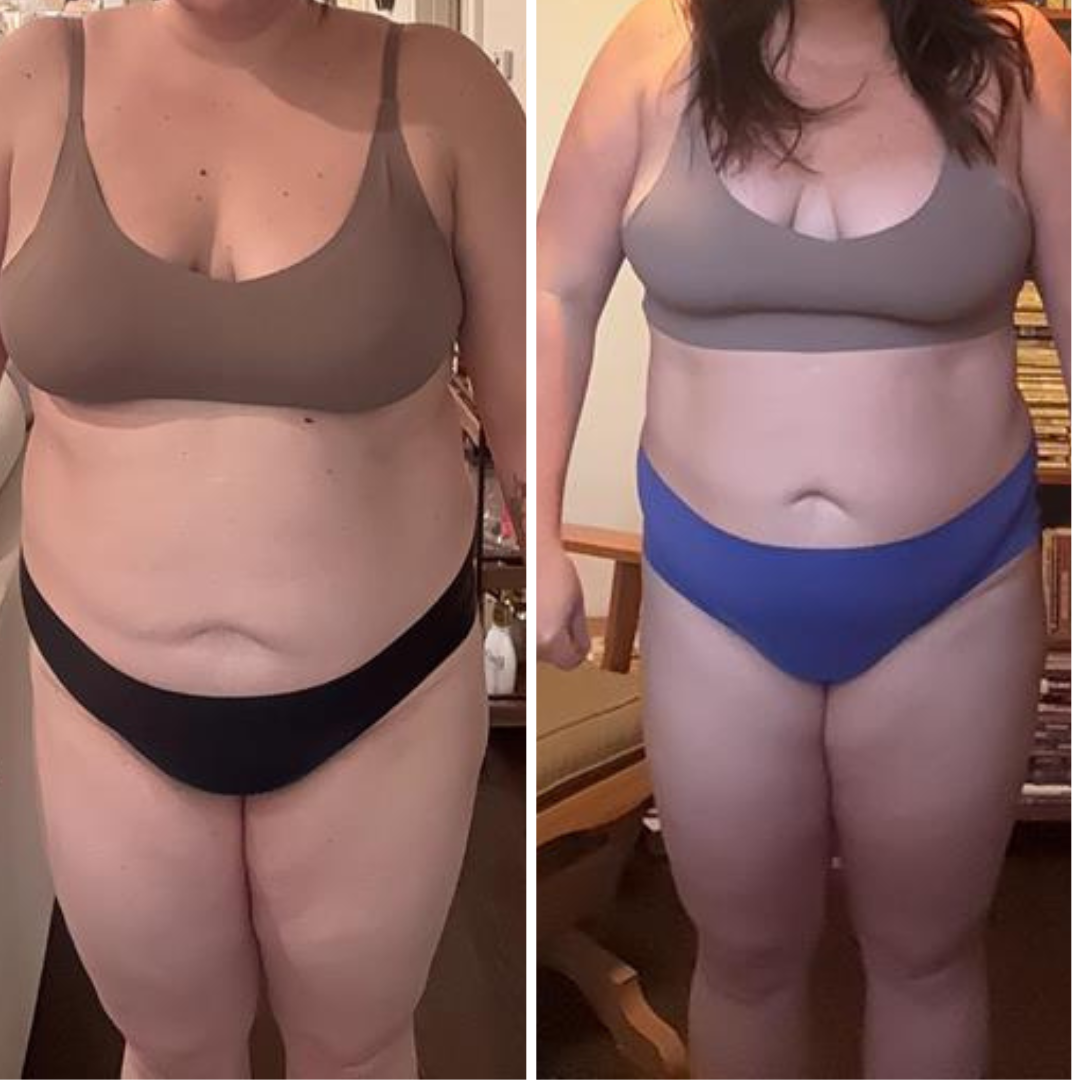 Side-by-side comparison of a woman before and after weight loss, wearing a sports bra and underwear in each photo.