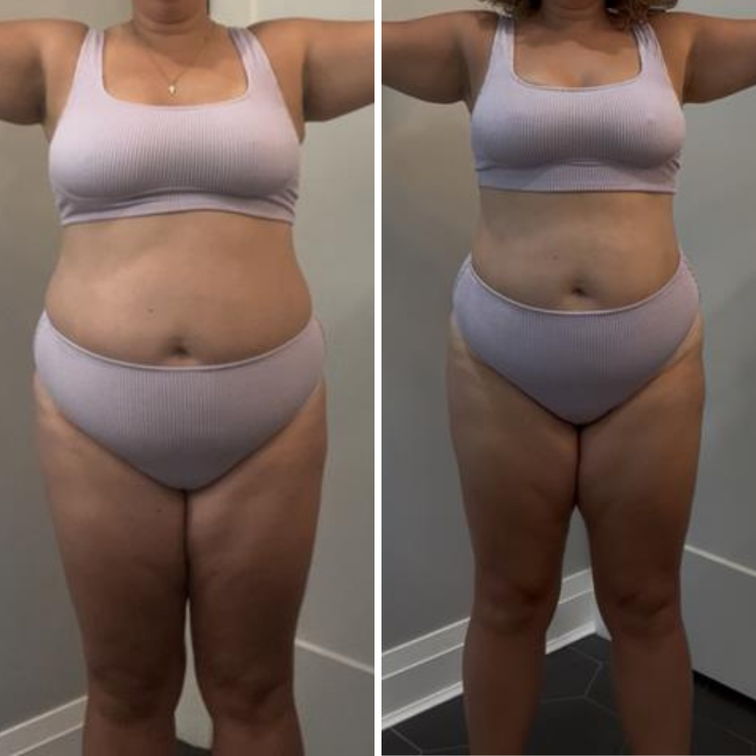 Before and after photos of a woman showing weight loss transformation.