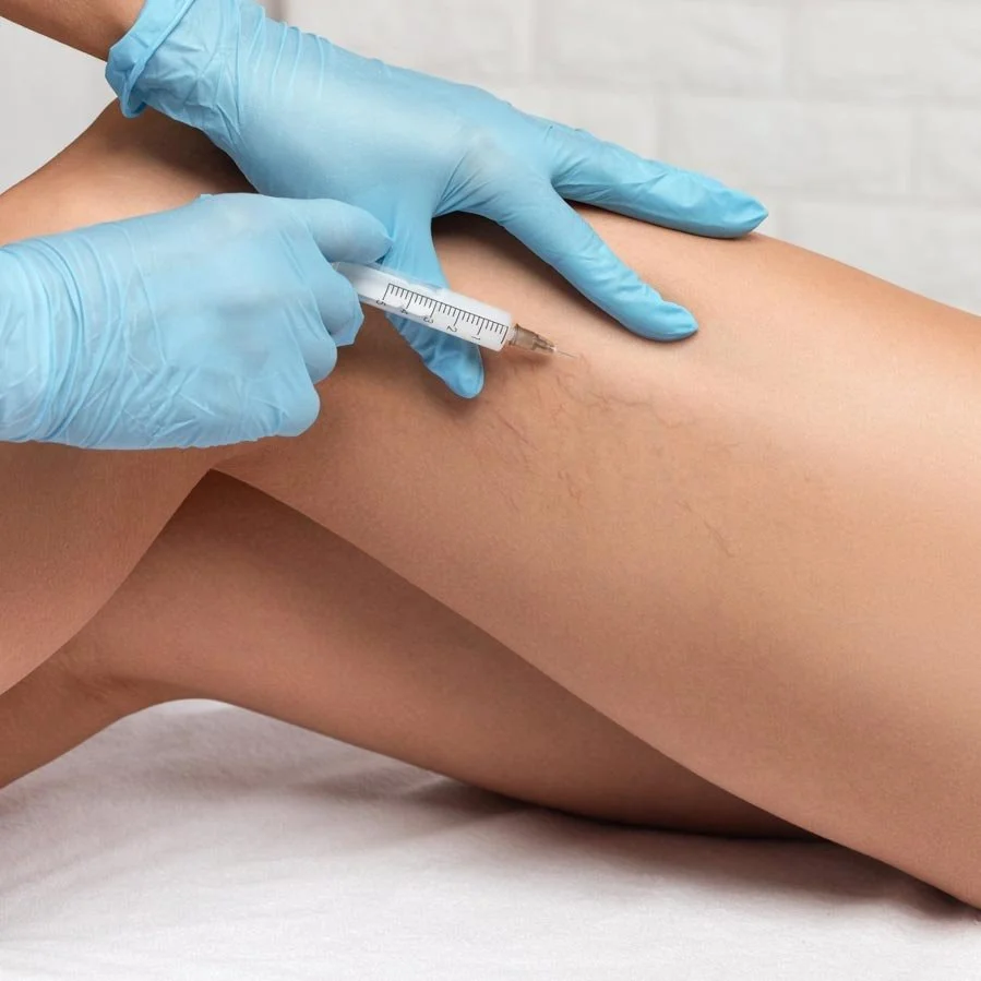 A healthcare professional wearing blue gloves administering an injection into a person's thigh, likely for medical treatment or cosmetic purposes.