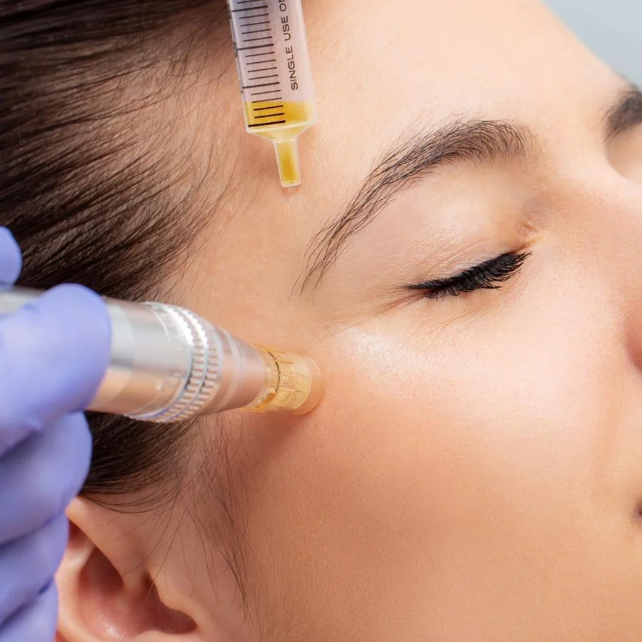 Close-up of a woman receiving a cosmetic injection in her cheek, with a syringe and a small vial visible near her face, indicating a dermatological or aesthetic procedure.