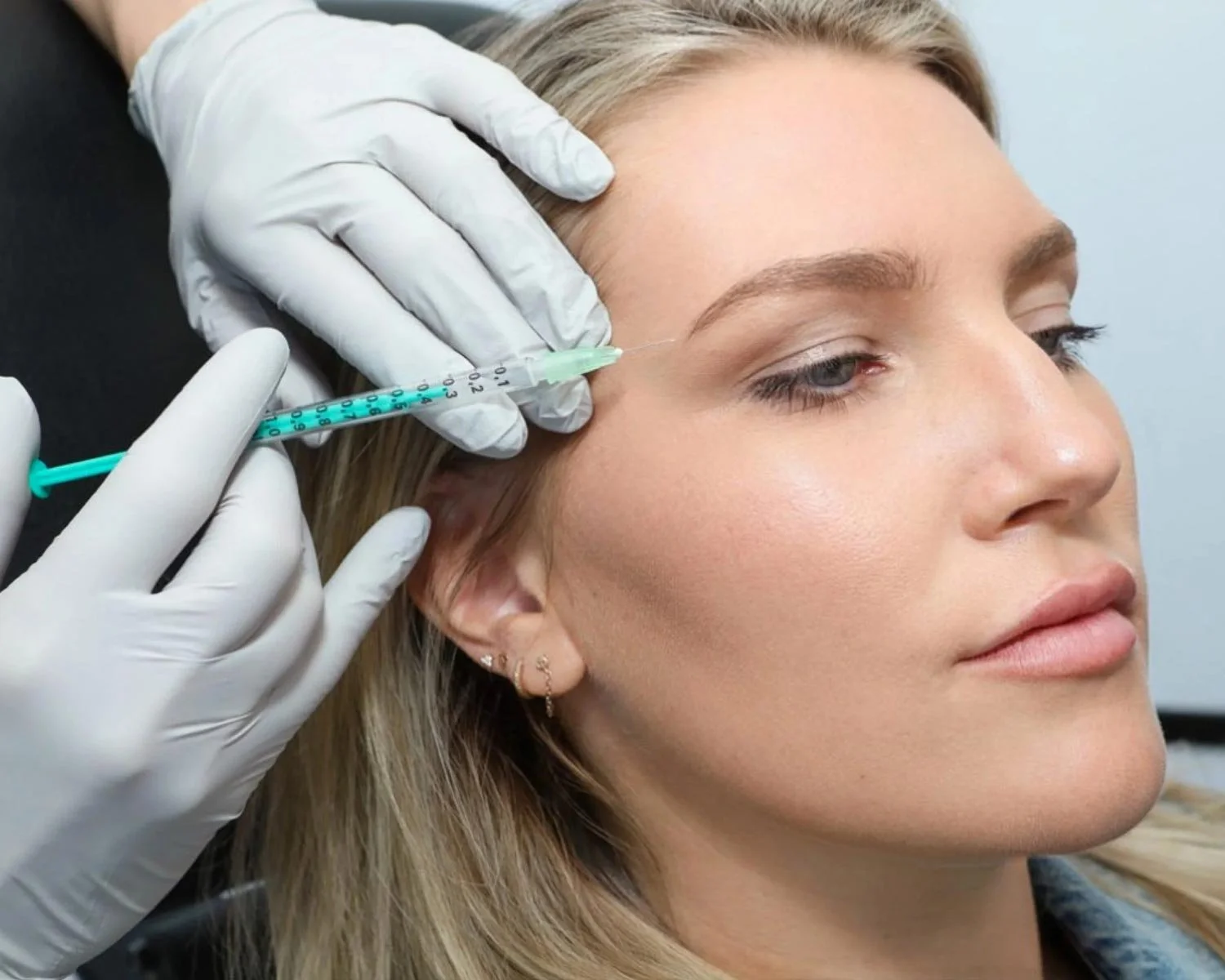 A woman receiving a cosmetic injection near her eyebrow while lying down, with a healthcare professional wearing white gloves performing the procedure.