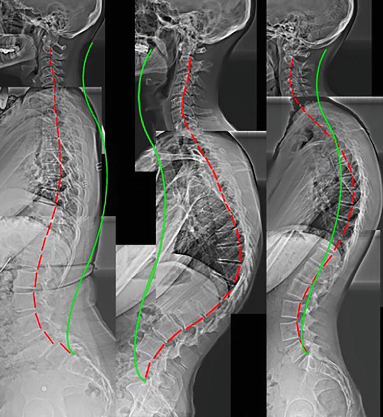Various examples of structural abnormalities as seen on digital radiography (x-ray), green line represents normal alignment, red line represents patient's alignment
