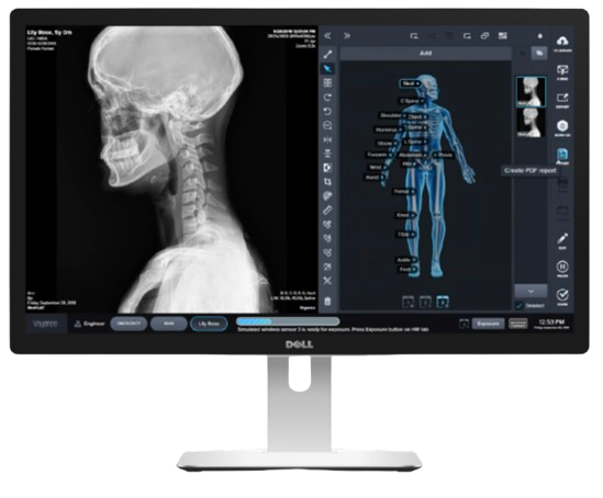 State-of-the-art precision structural radiographs
