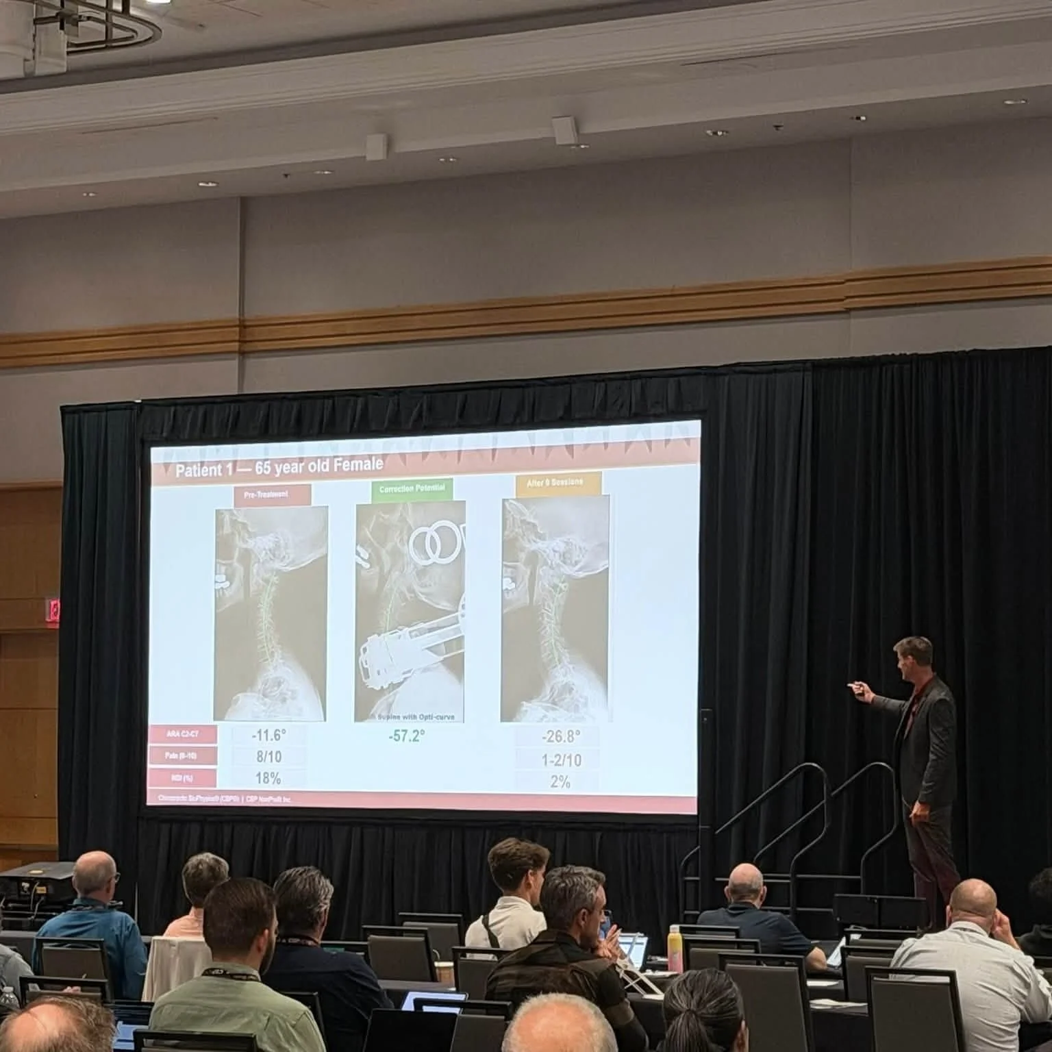 Presenter at the 48th Annual CBP Conference showing cervical spine X-ray data with pre-treatment and post-treatment structural correction results