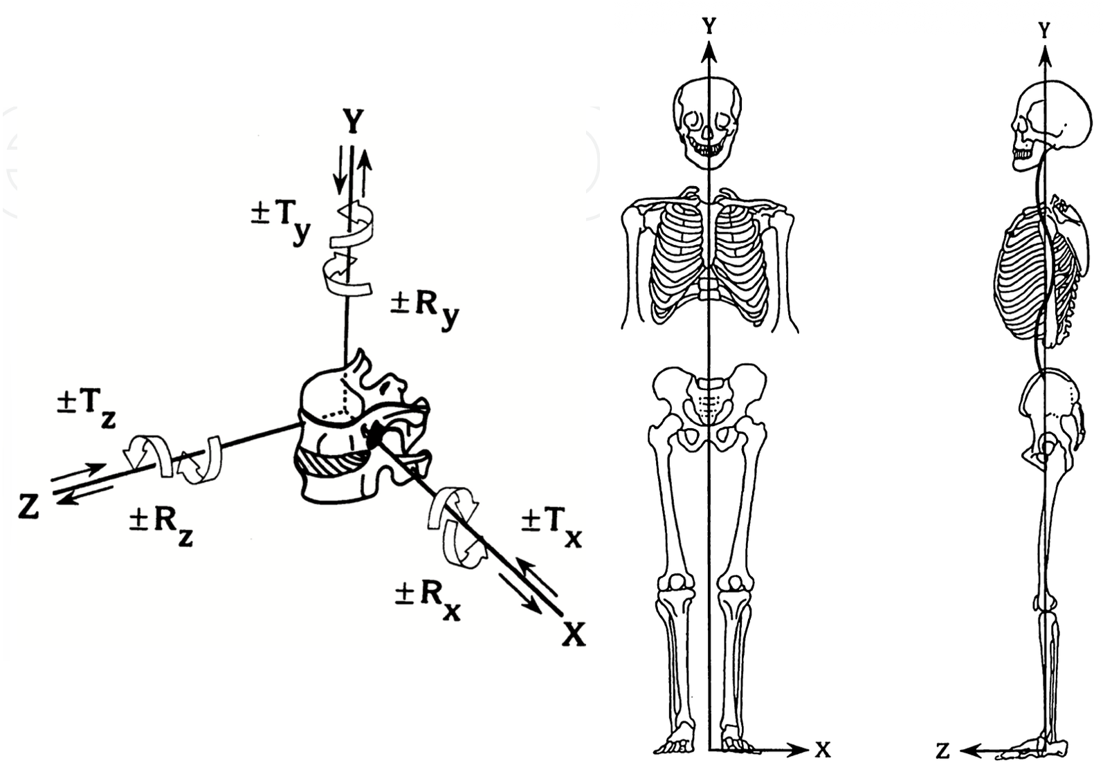 Diagram of a vertebra on X, Y, and Z axes showing three translations and three rotations, beside front and side skeletons with a vertical Y axis