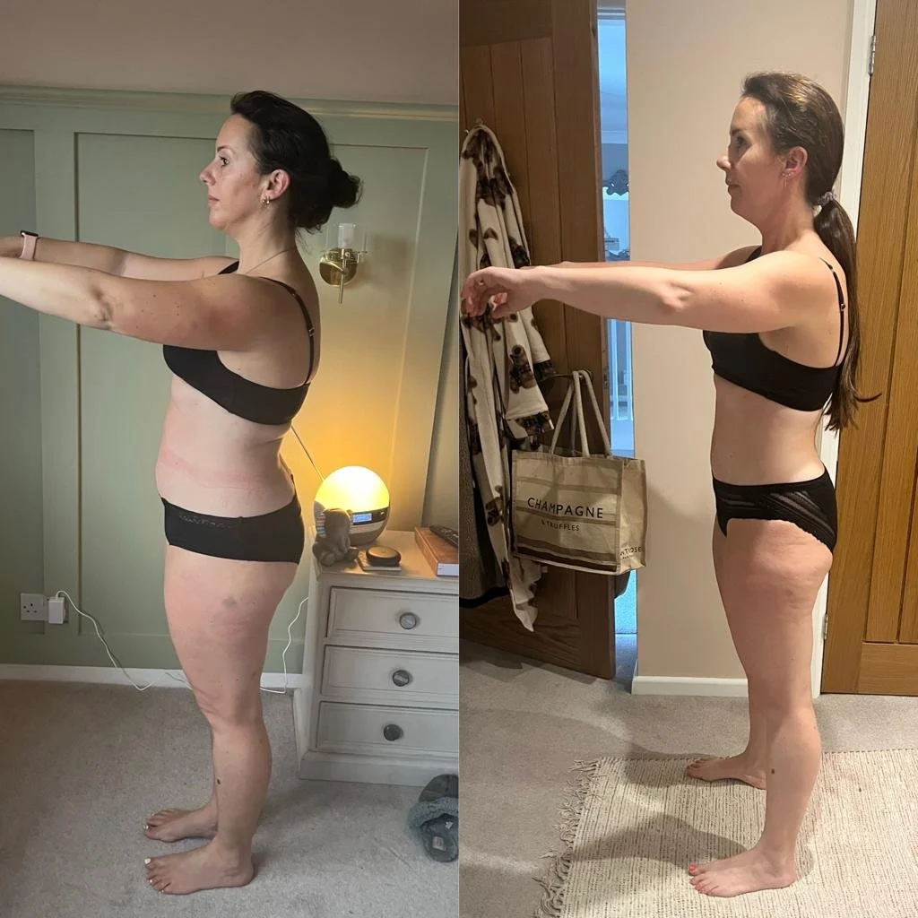 Side-by-side comparison of a woman in black underwear before and after a weight loss journey, showing reductions in body size and improved body shape.