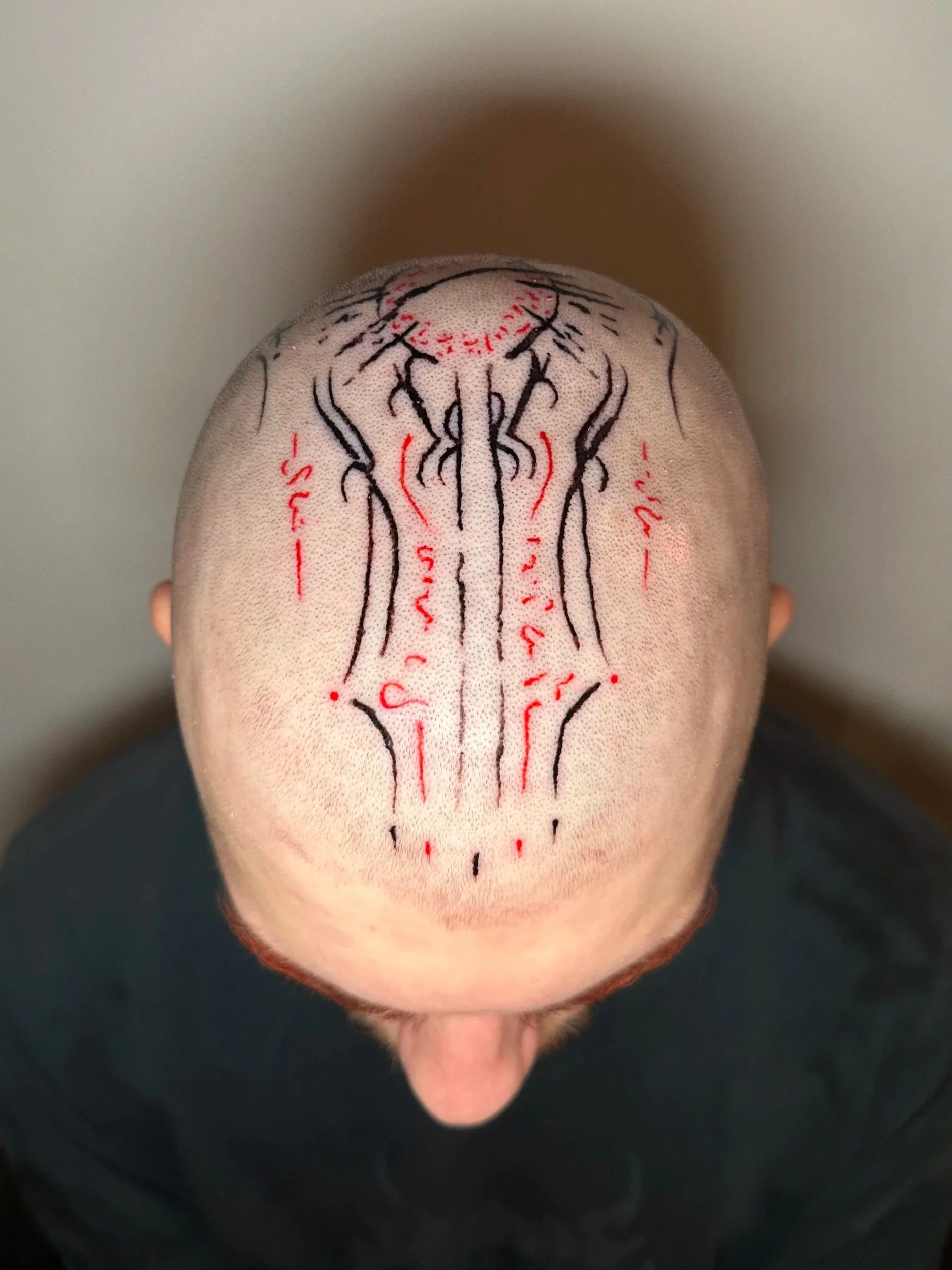 Kopf mit Tattoo, das eine medizinische Skizze der Blutgefäße auf der Kopfhaut zeigt, mit roten und schwarzen Linien.