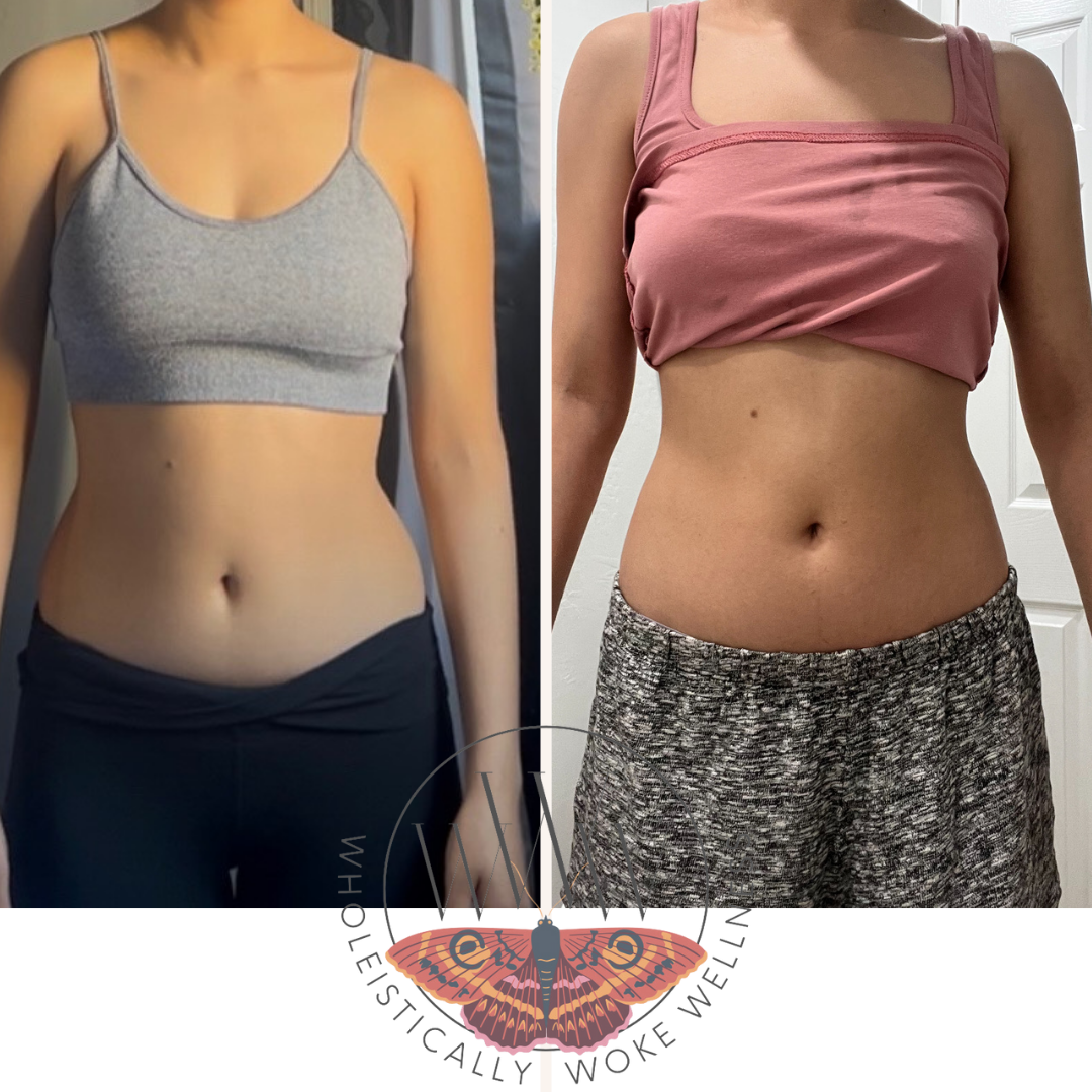 Before after minimal skincare Instagram post.png.PNG (1).png