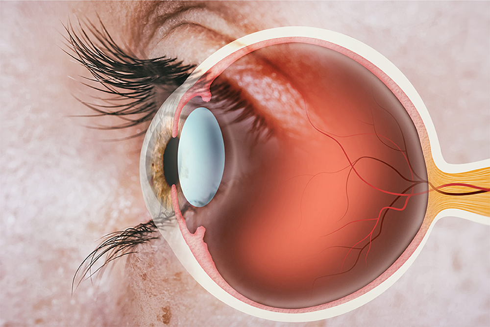 At Gawler Eye Clinic, our experienced ophthalmologists are dedicated to diagnosing, treating, and managing all forms of medical and surgical retinal diseases.