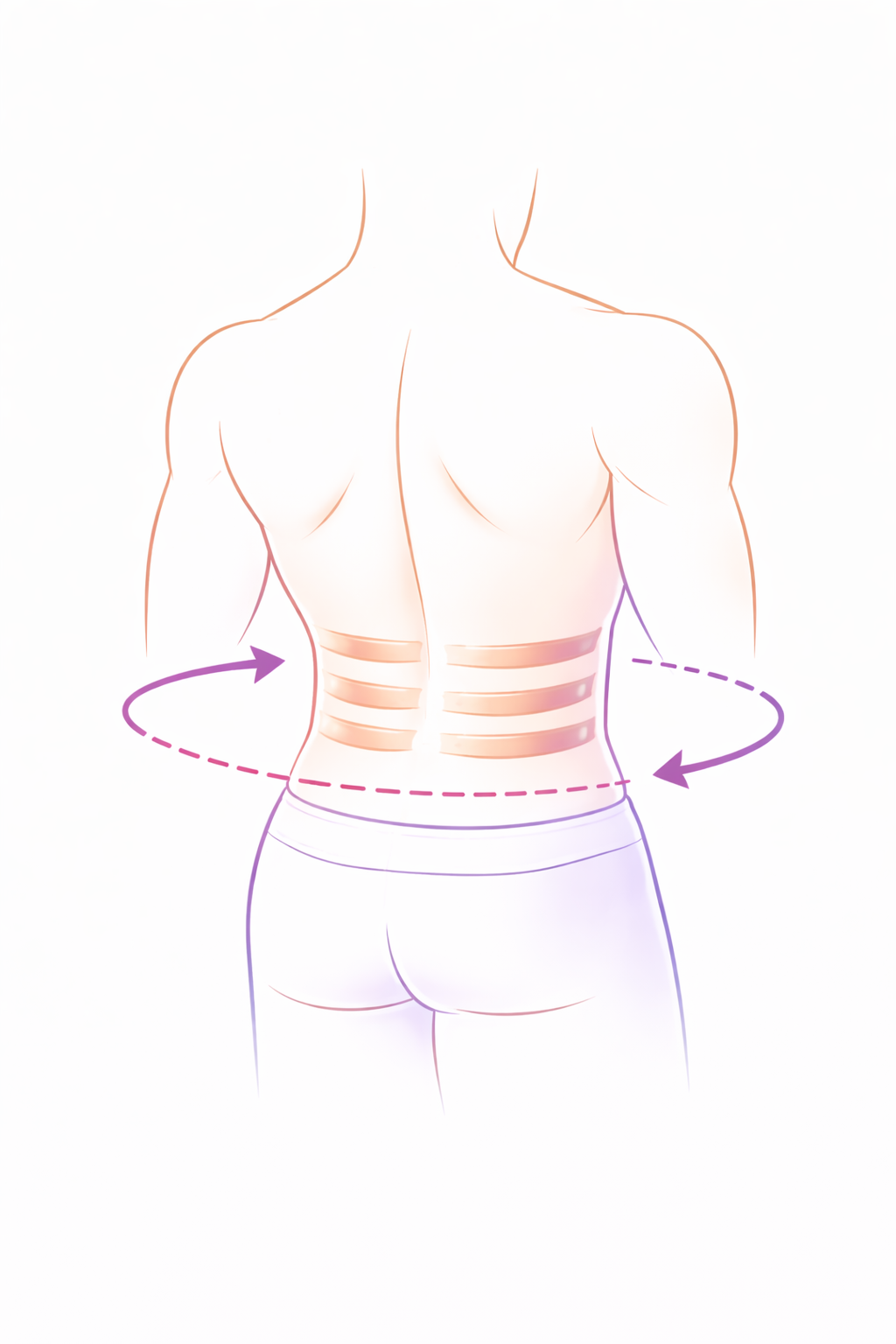 A diagram illustrating a person's back with focus on the waist and flanks, indicating areas for possible surgical liposuction indicated by purple arrows around the torso.
