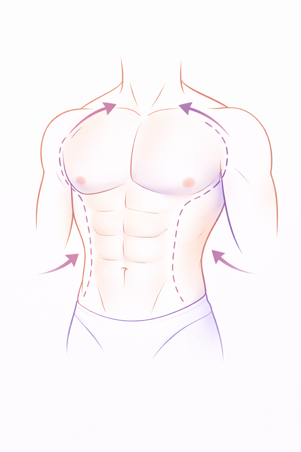 A diagram of a muscular male upper body with arrows indicating areas for possible surgical procedures, including the chest, sides, and abdomen.