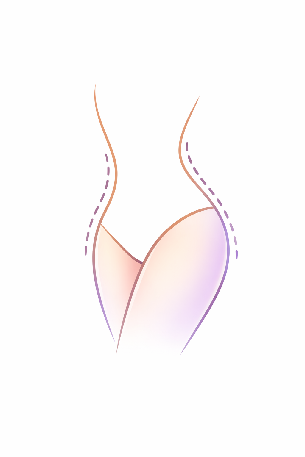 An illustration of feminine curves with dashed purple lines indicating areas for potential body contouring or shaping.