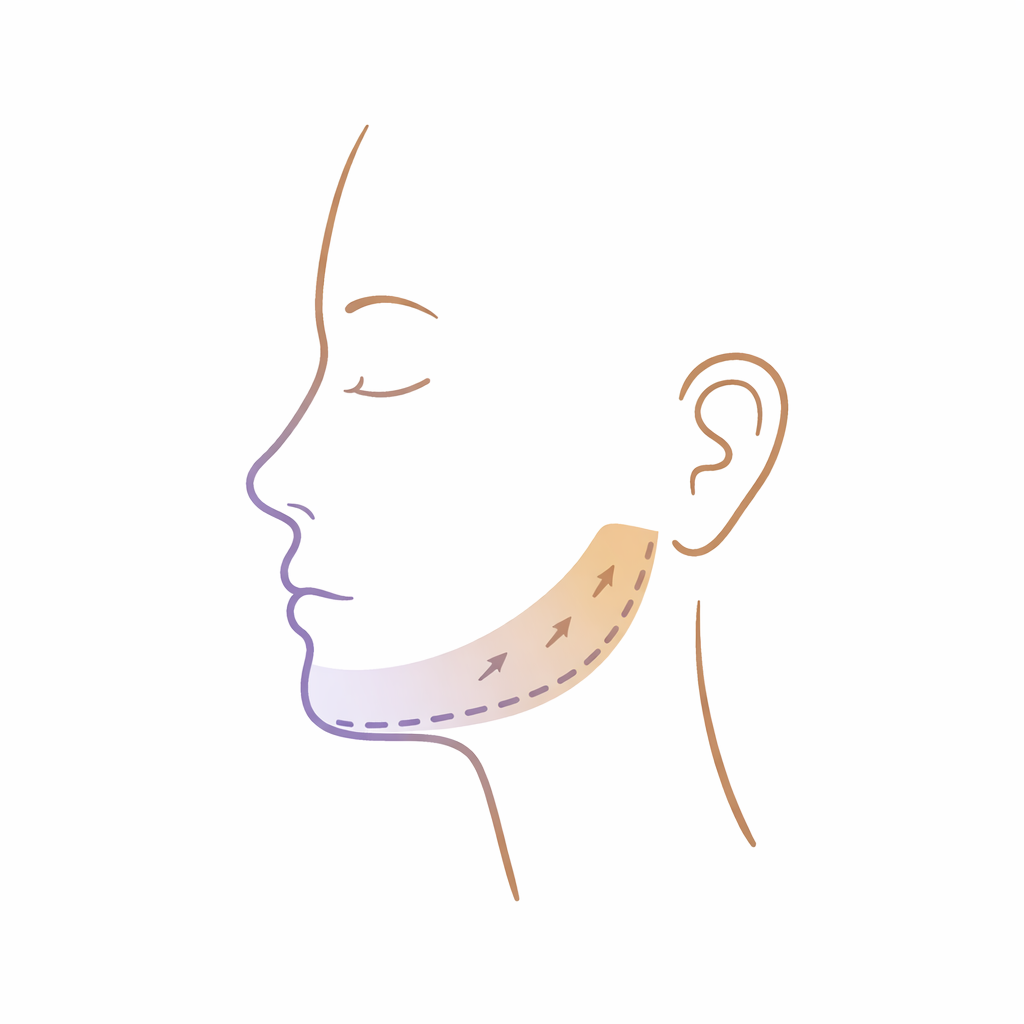 Line drawing of a woman's side profile with arrows indicating skin tightening and lifting on the neck.