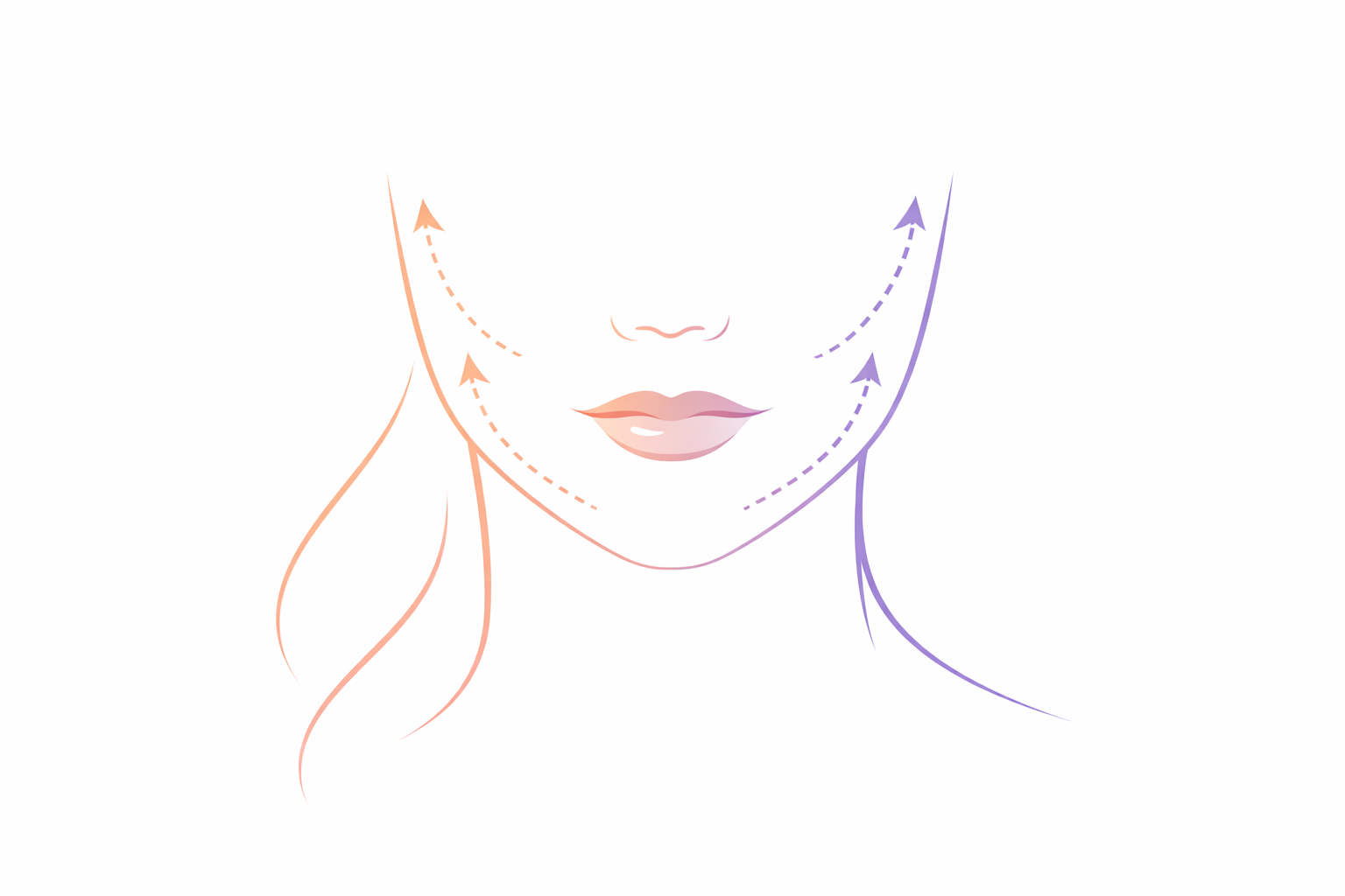 Line drawing of a woman's lower face and neck, with arrows indicating upward lift on both sides of the chin, in pastel colors.