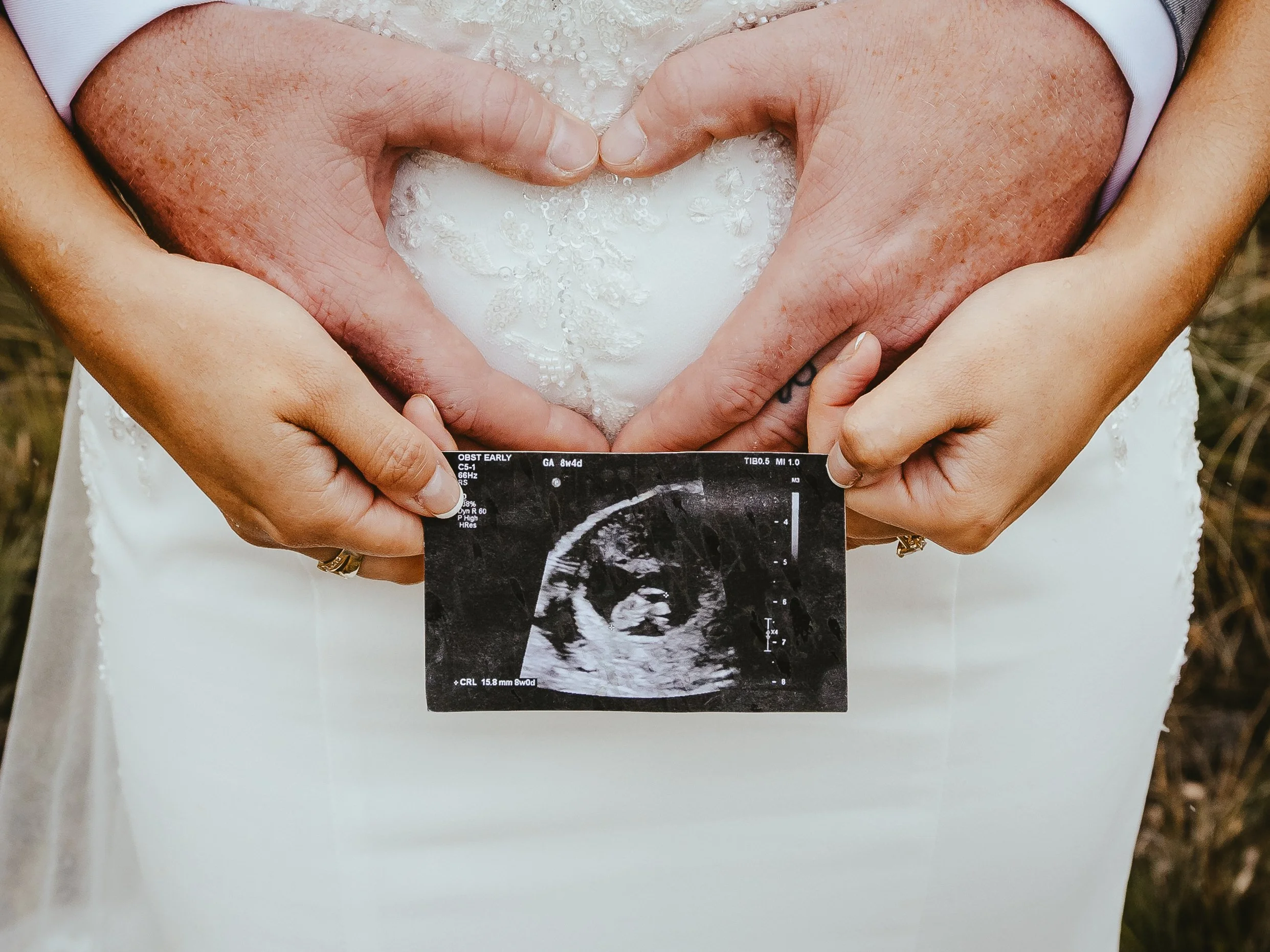 A person in a wedding dress making a heart shape with their hands around an ultrasound picture of a baby.
