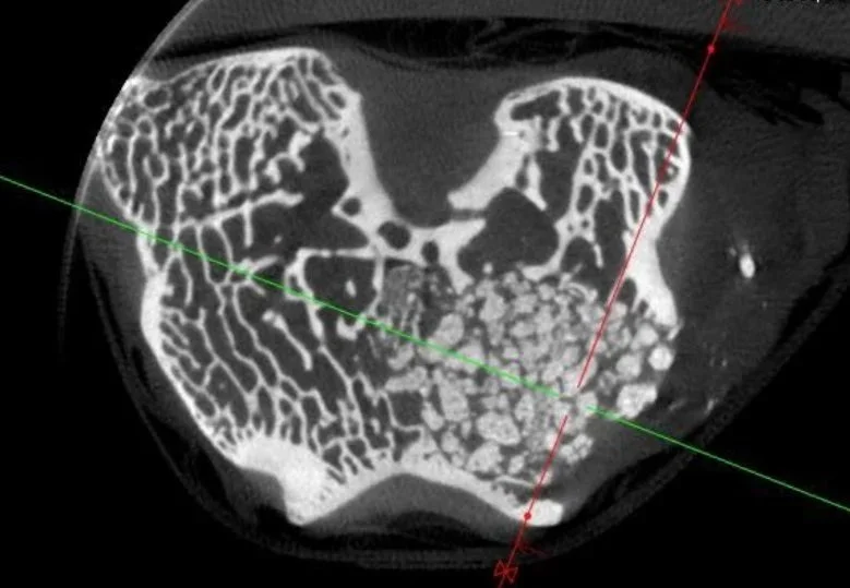 Micro-CT scan of bone structure showing detailed internal architecture