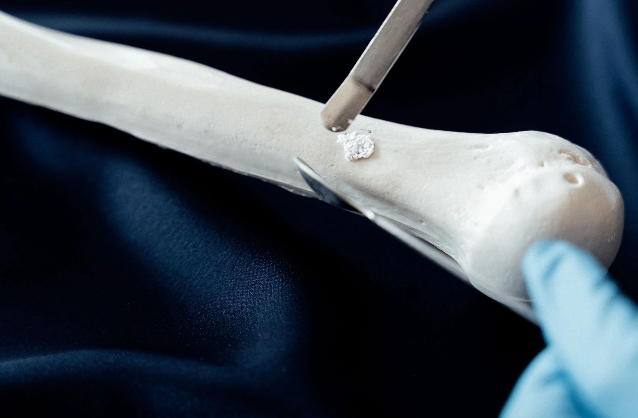 Laboratory technician handling PearlBone™ biomaterial using a surgical spatula