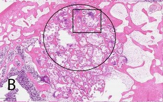 Histology image of stained biomaterial sample showing microstructure with annotated regions of interest