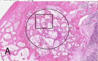 Microscopic view of stained sample with annotated regions indicating areas of interest