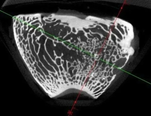 Micro-CT cross-sectional image highlighting structural composition of mineralised material